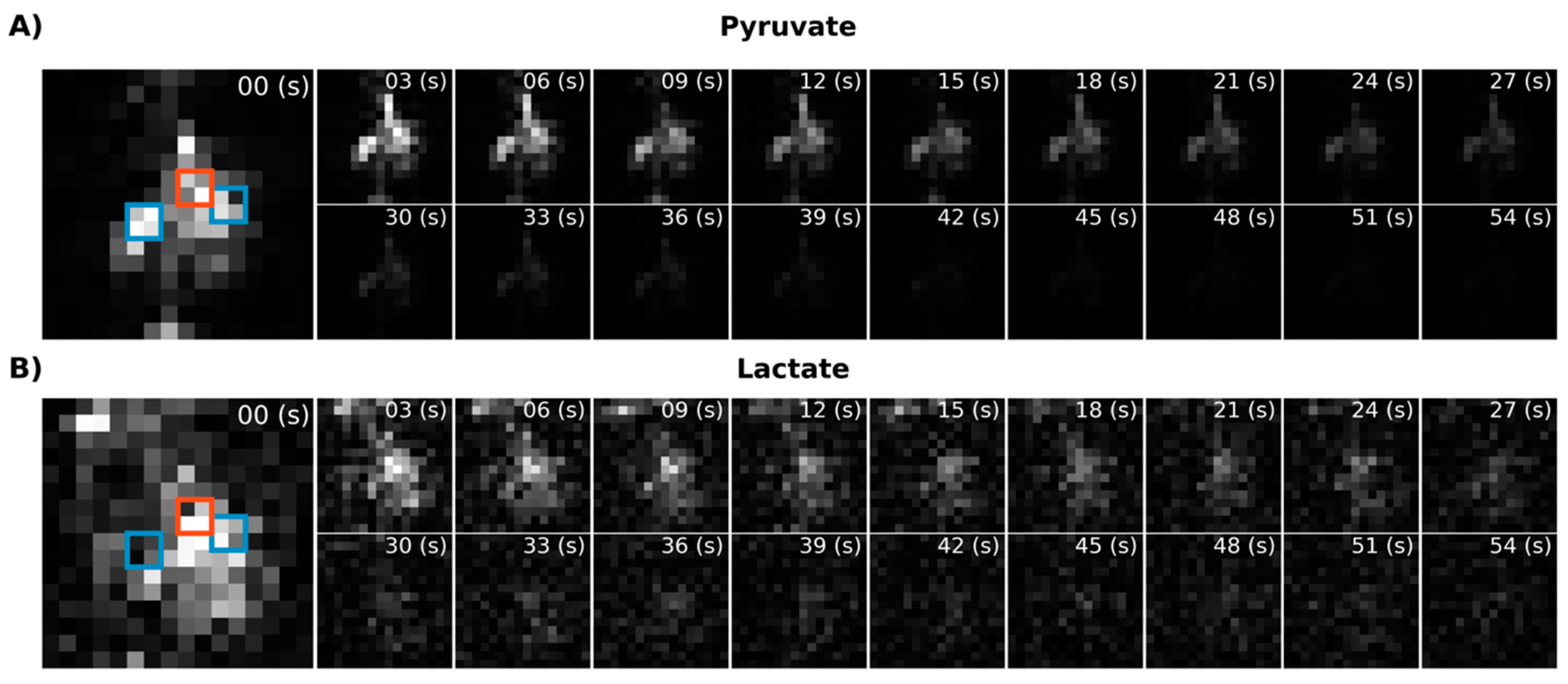 Tomography 07 00040 g005 550