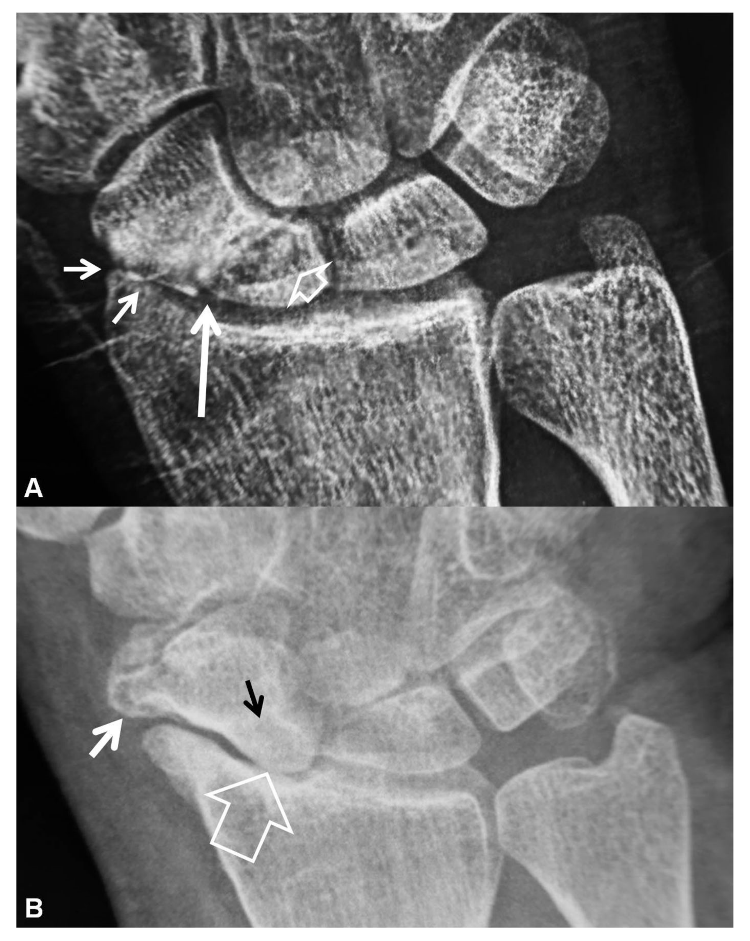 Tomography 07 00042 g003
