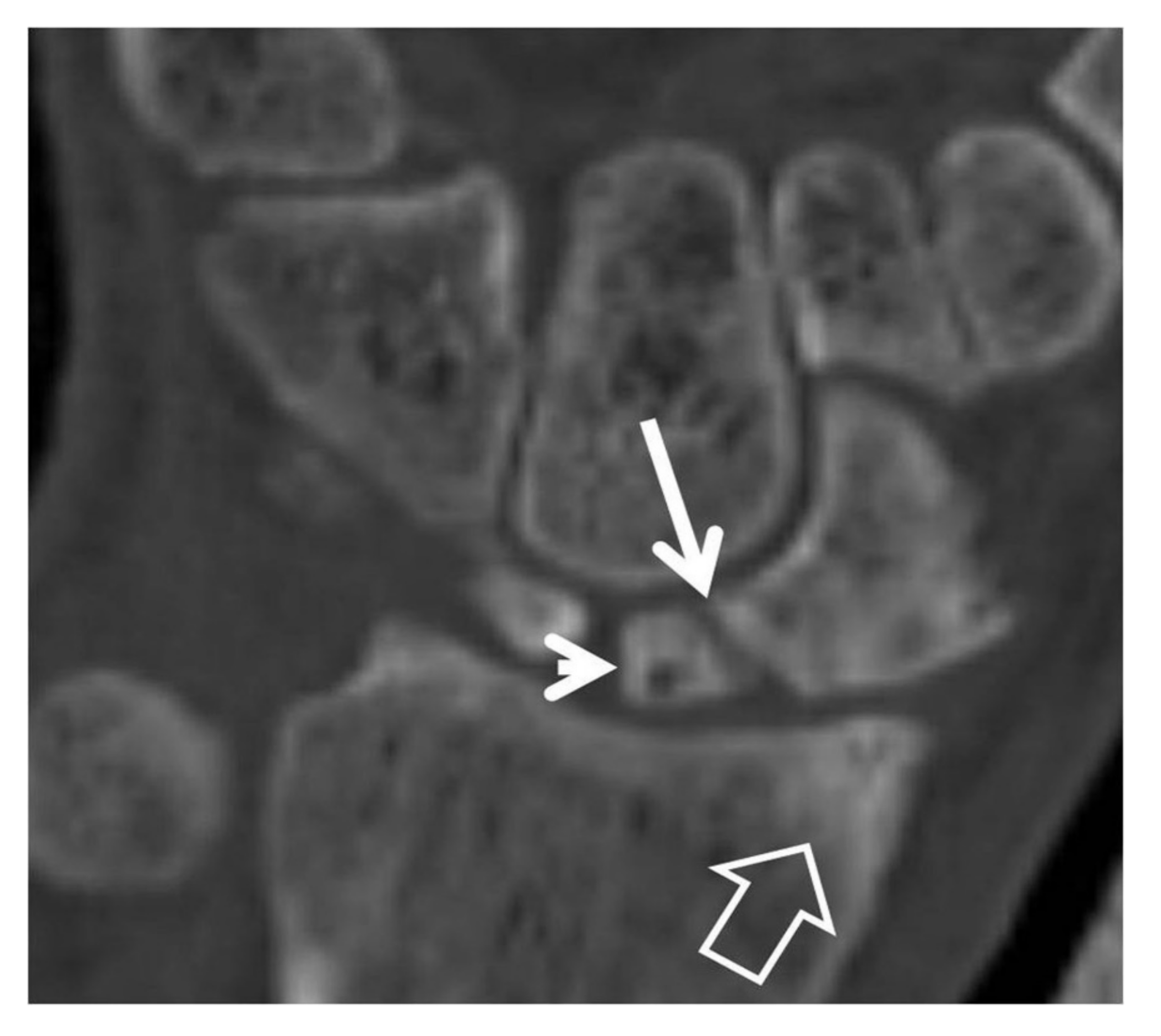 Tomography 07 00042 g009