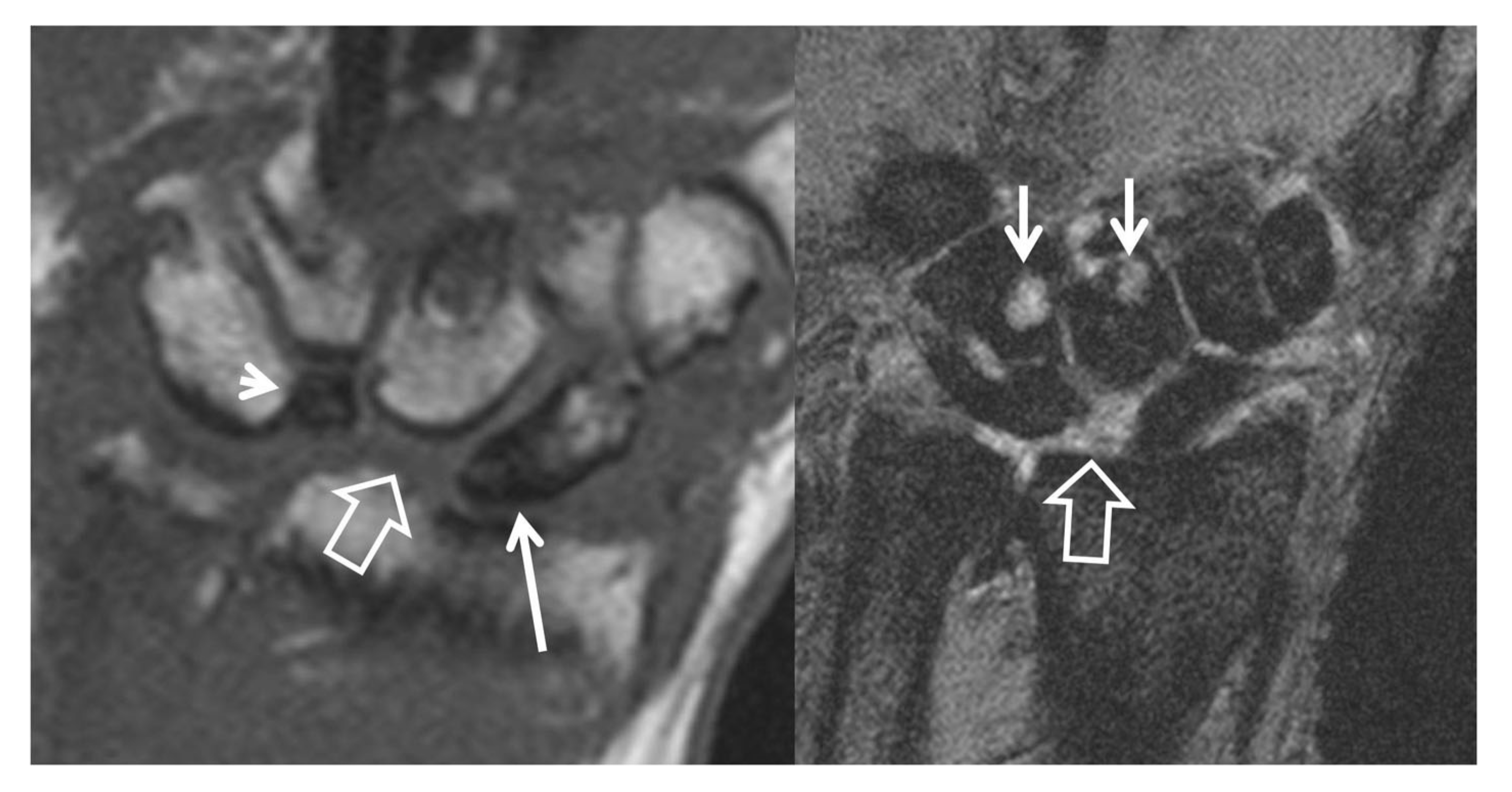 Tomography 07 00042 g010