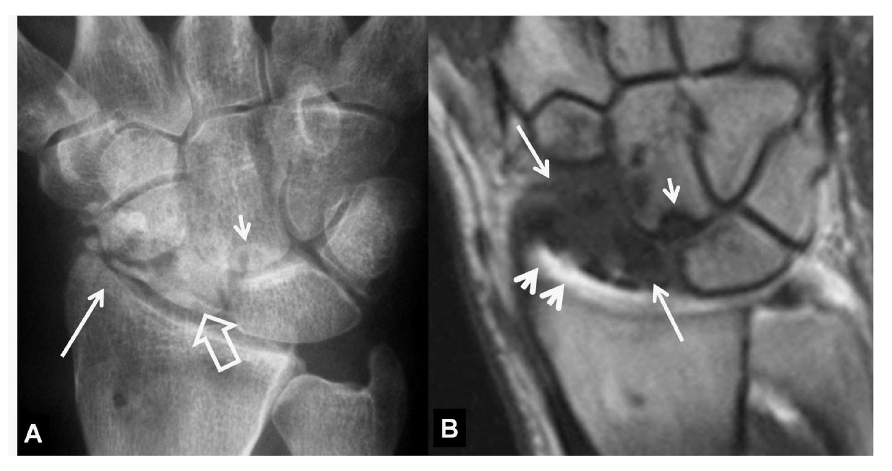 Tomography 07 00042 g013