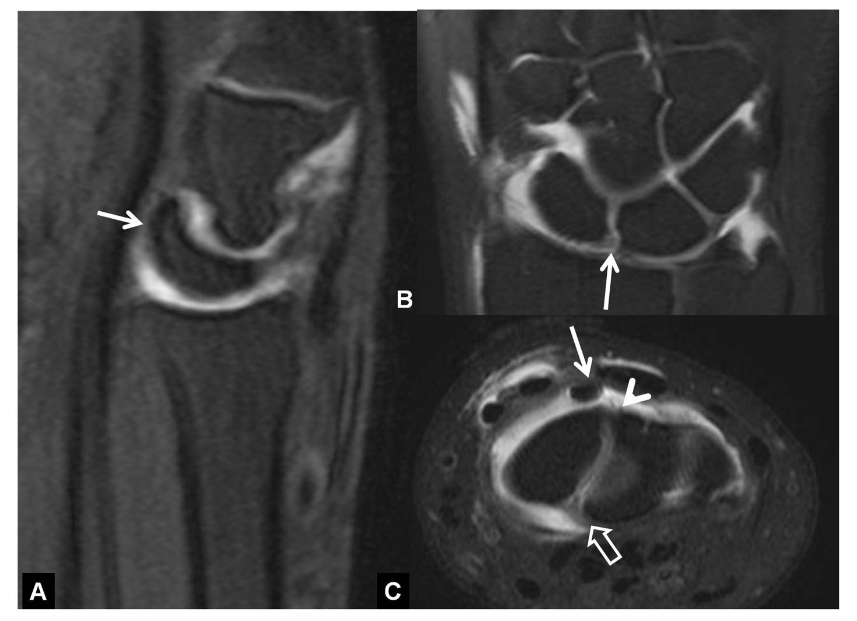 Tomography 07 00042 g014