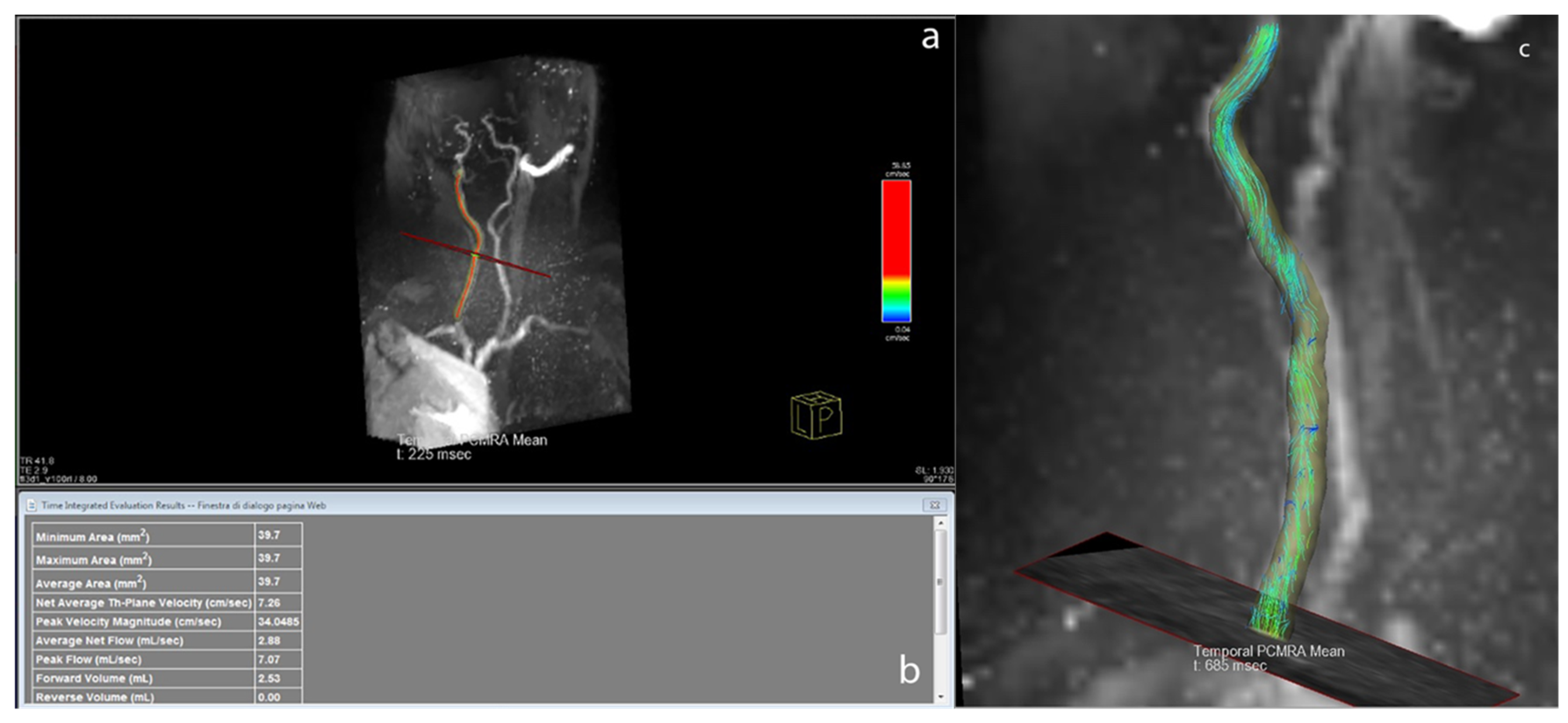 Tomography 07 00044 g002 550