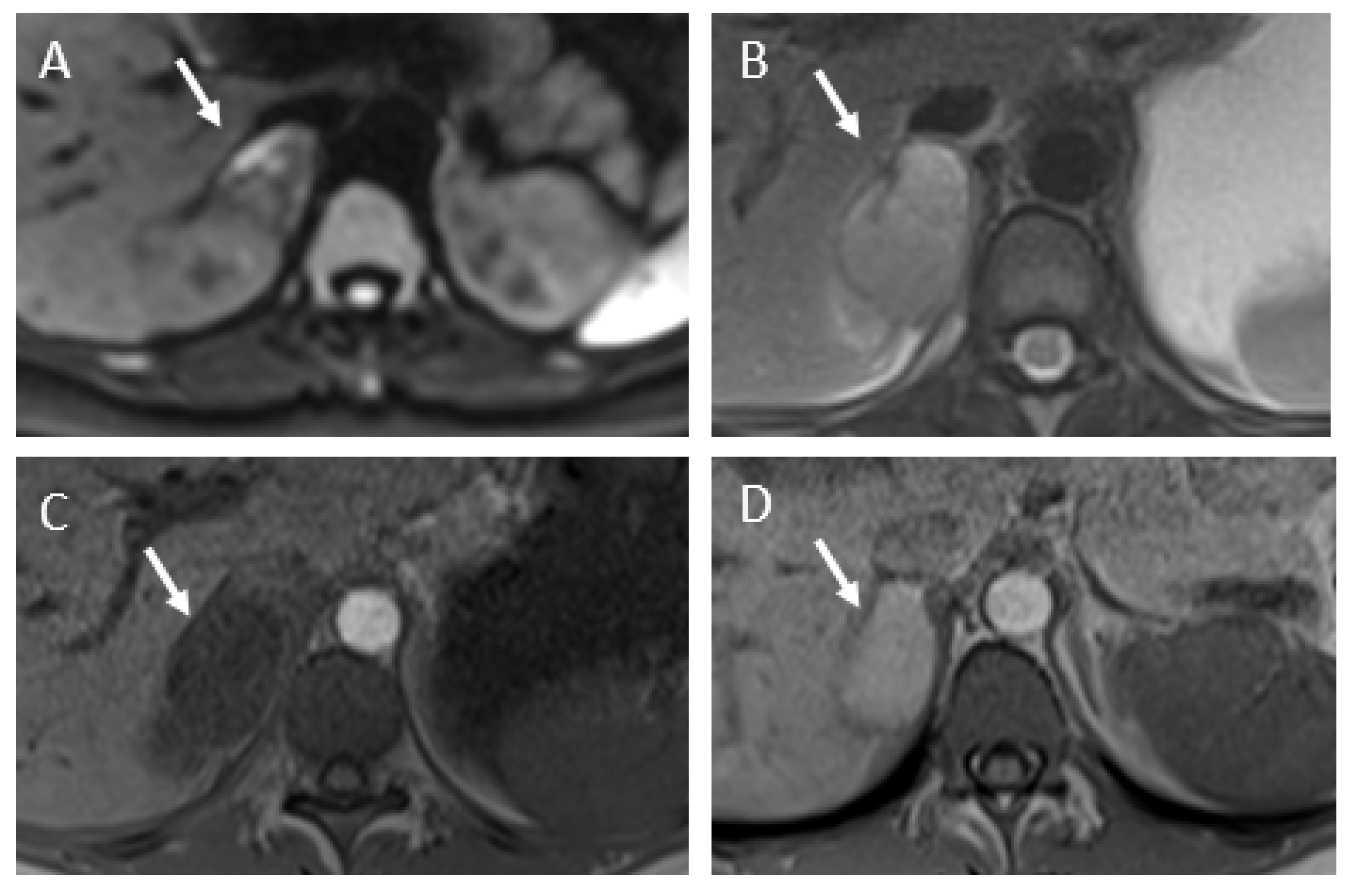 Tomography 07 00046 g006