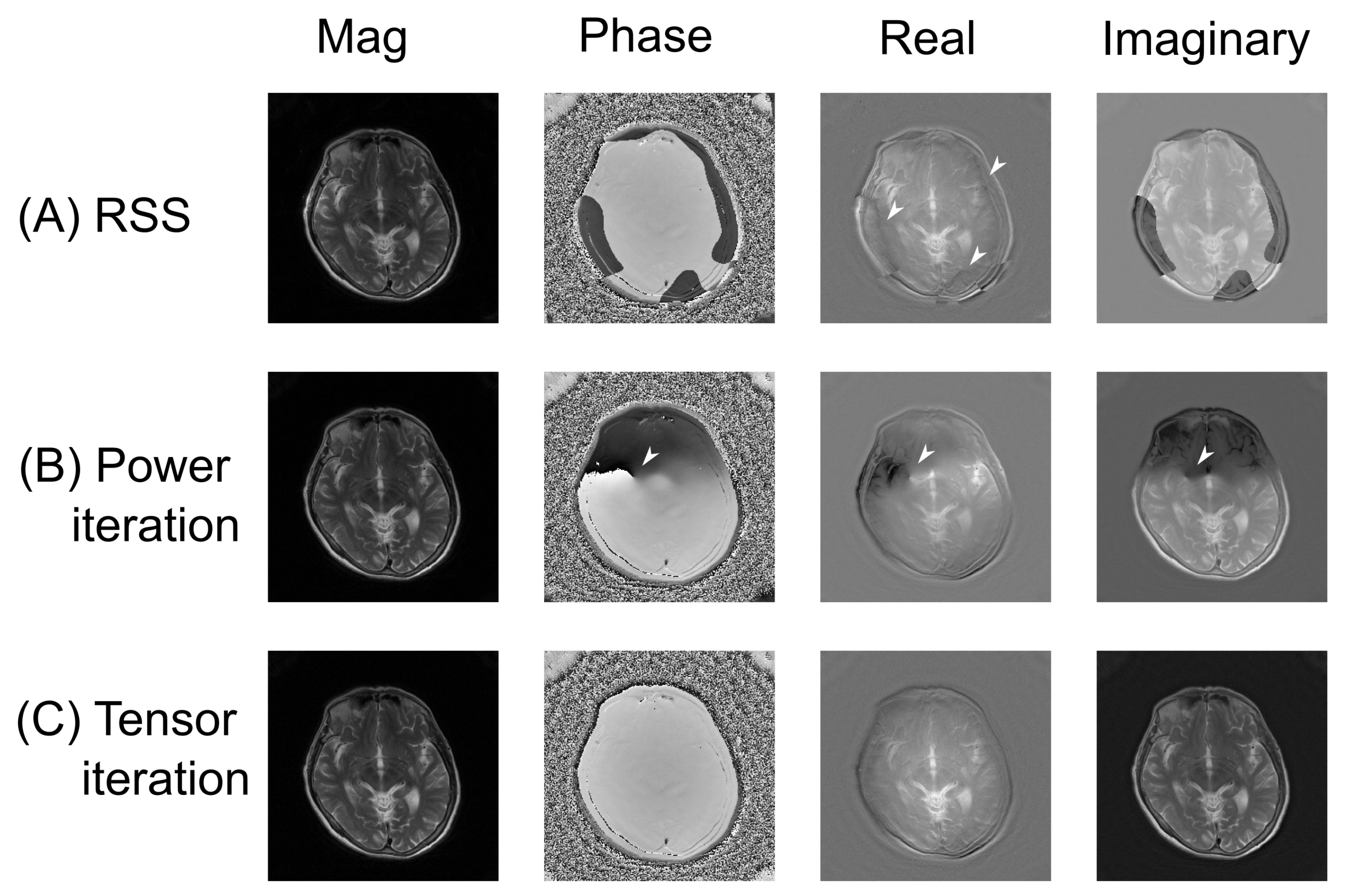 Tomography 07 00048 g003 Tomography 07 00048 g003