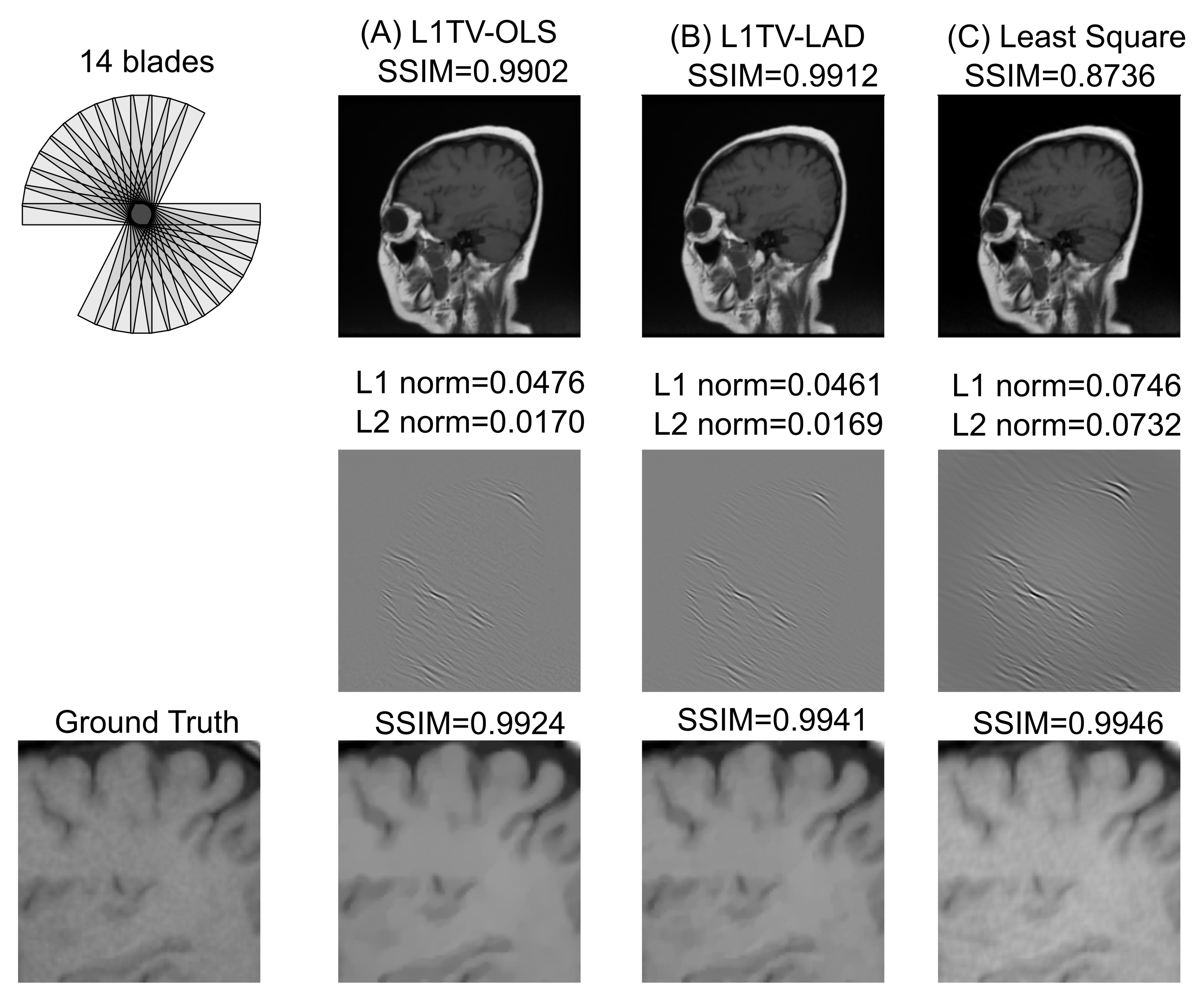 Tomography 07 00048 g004 Tomography 07 00048 g004