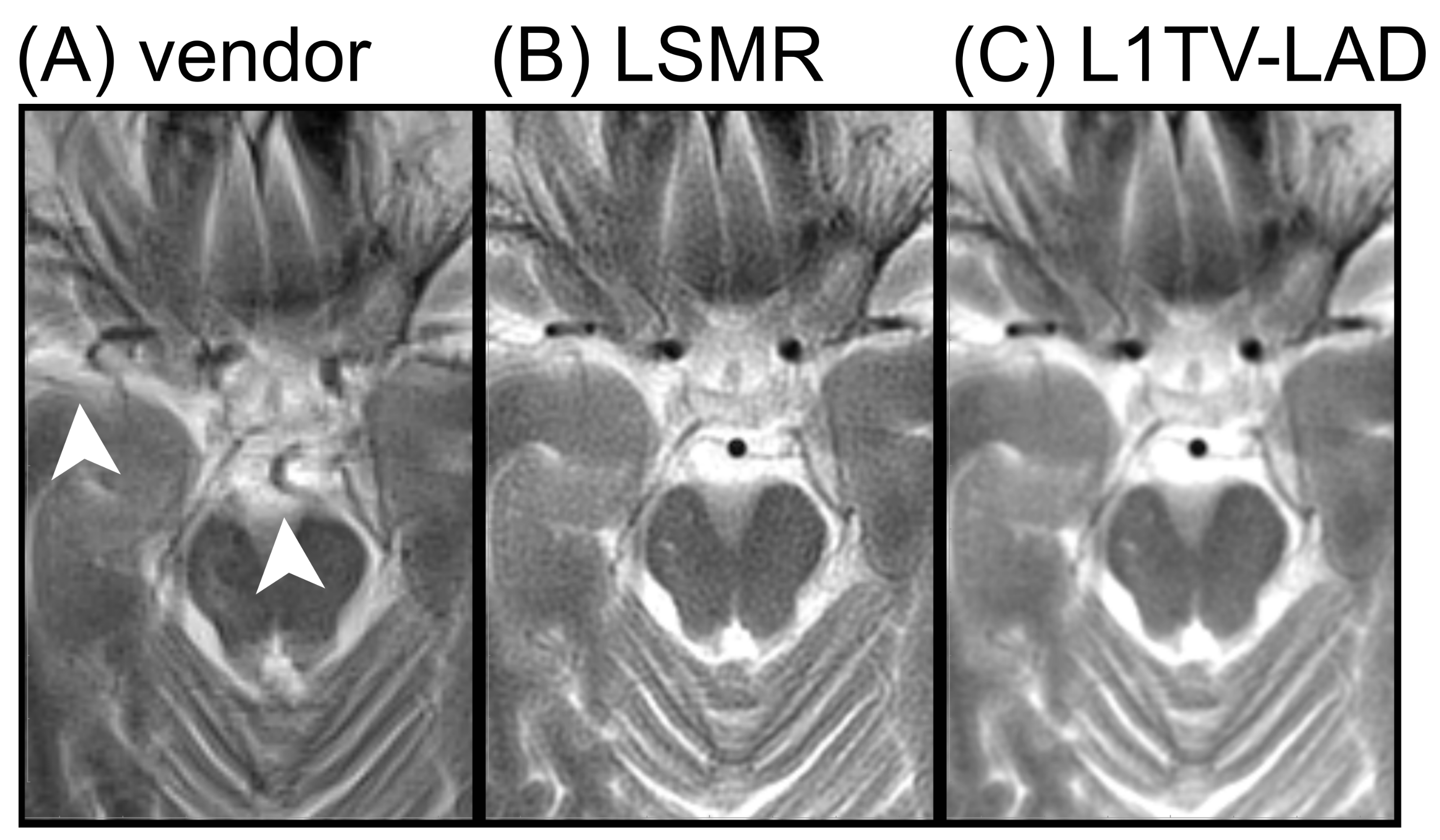 Tomography 07 00048 g006 Tomography 07 00048 g006