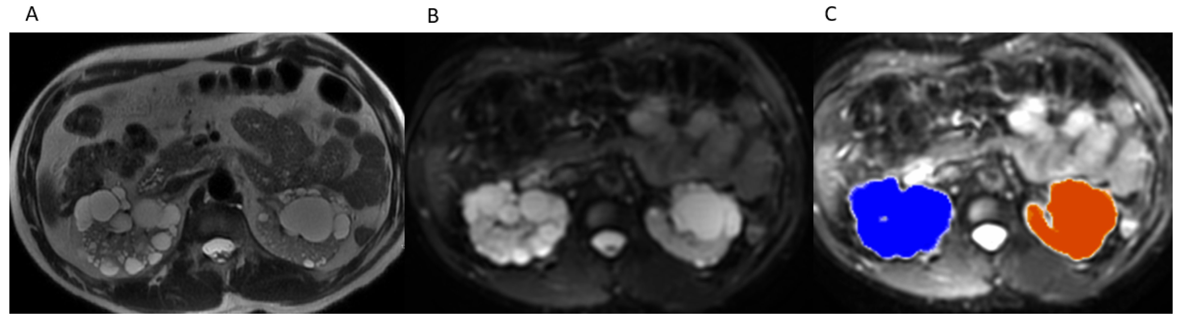Tomography 07 00049 g001