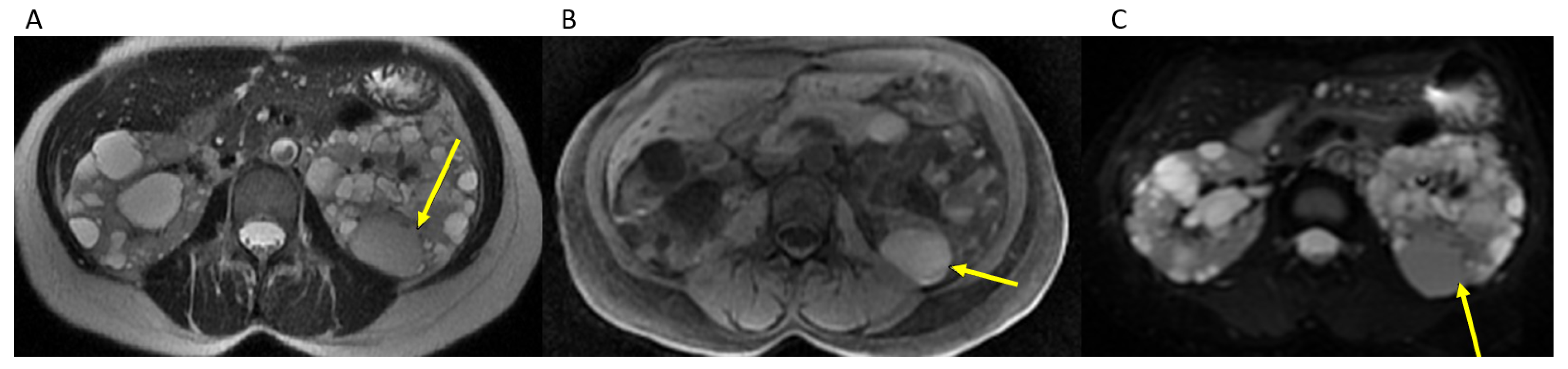 Tomography 07 00049 g003