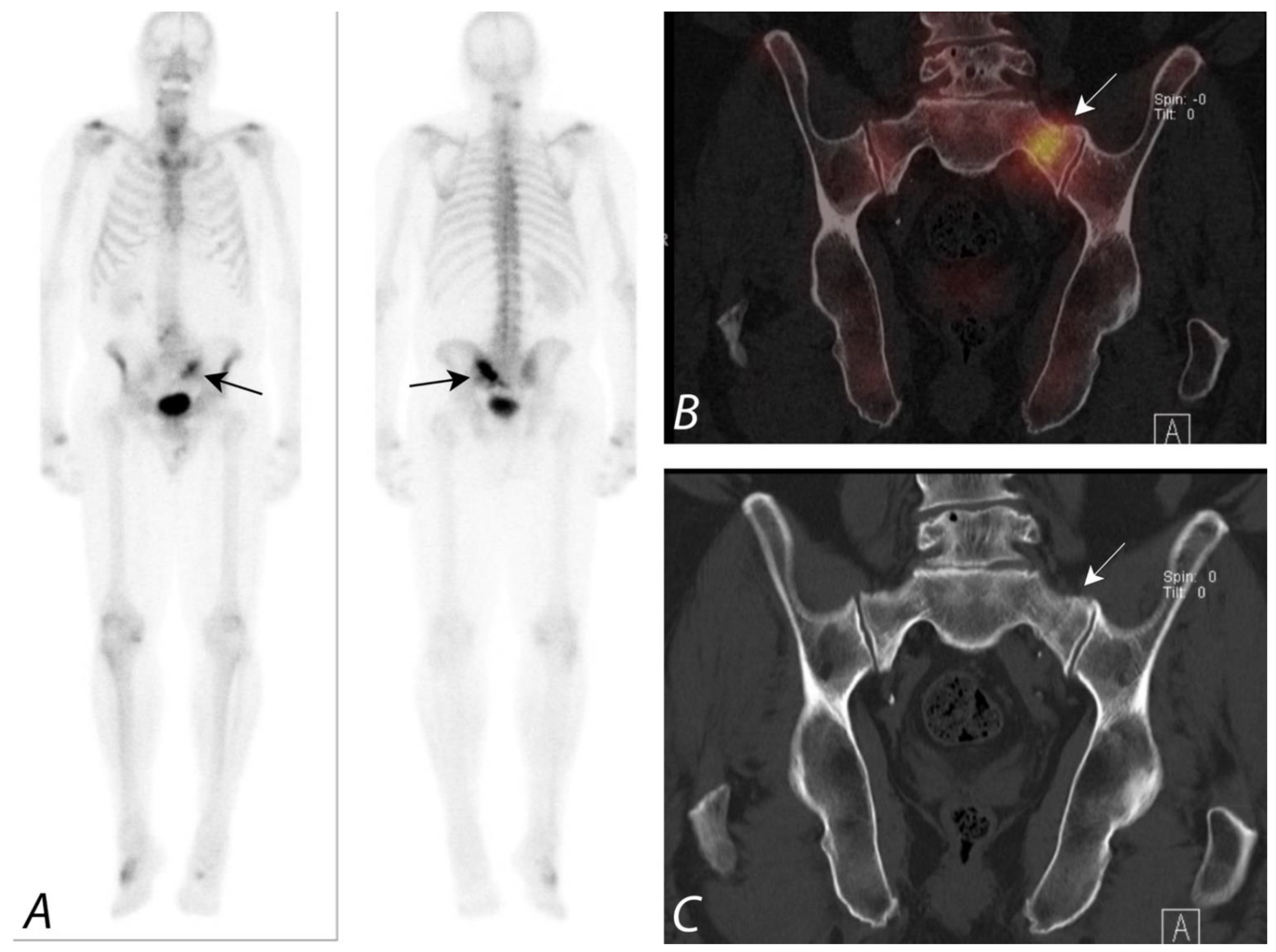 Népi gyógymódok a prosztatagyulladás fórum vélemények - A prostatitis amely segíti a véleményeket