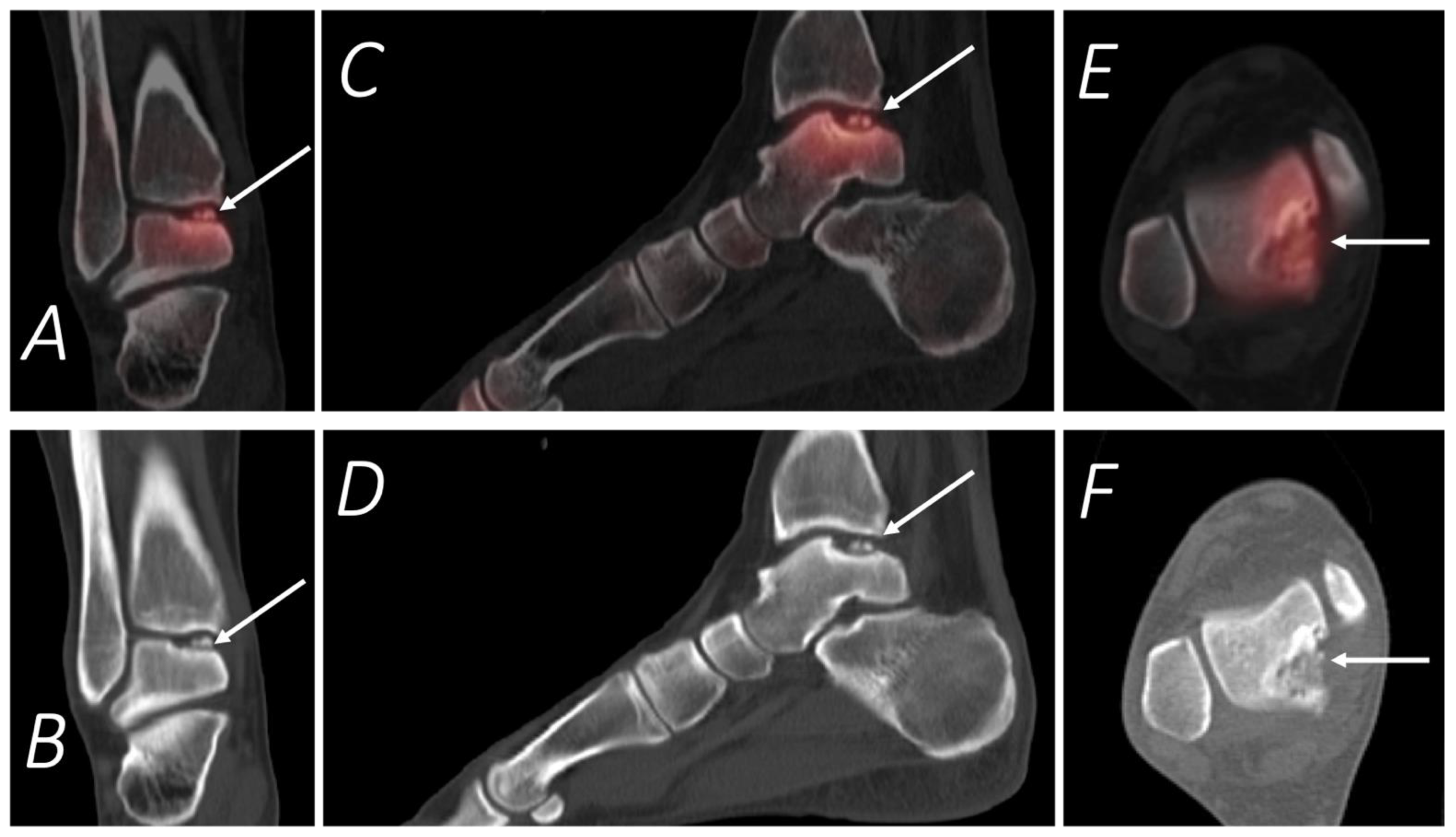 Tomography 07 00050 g010