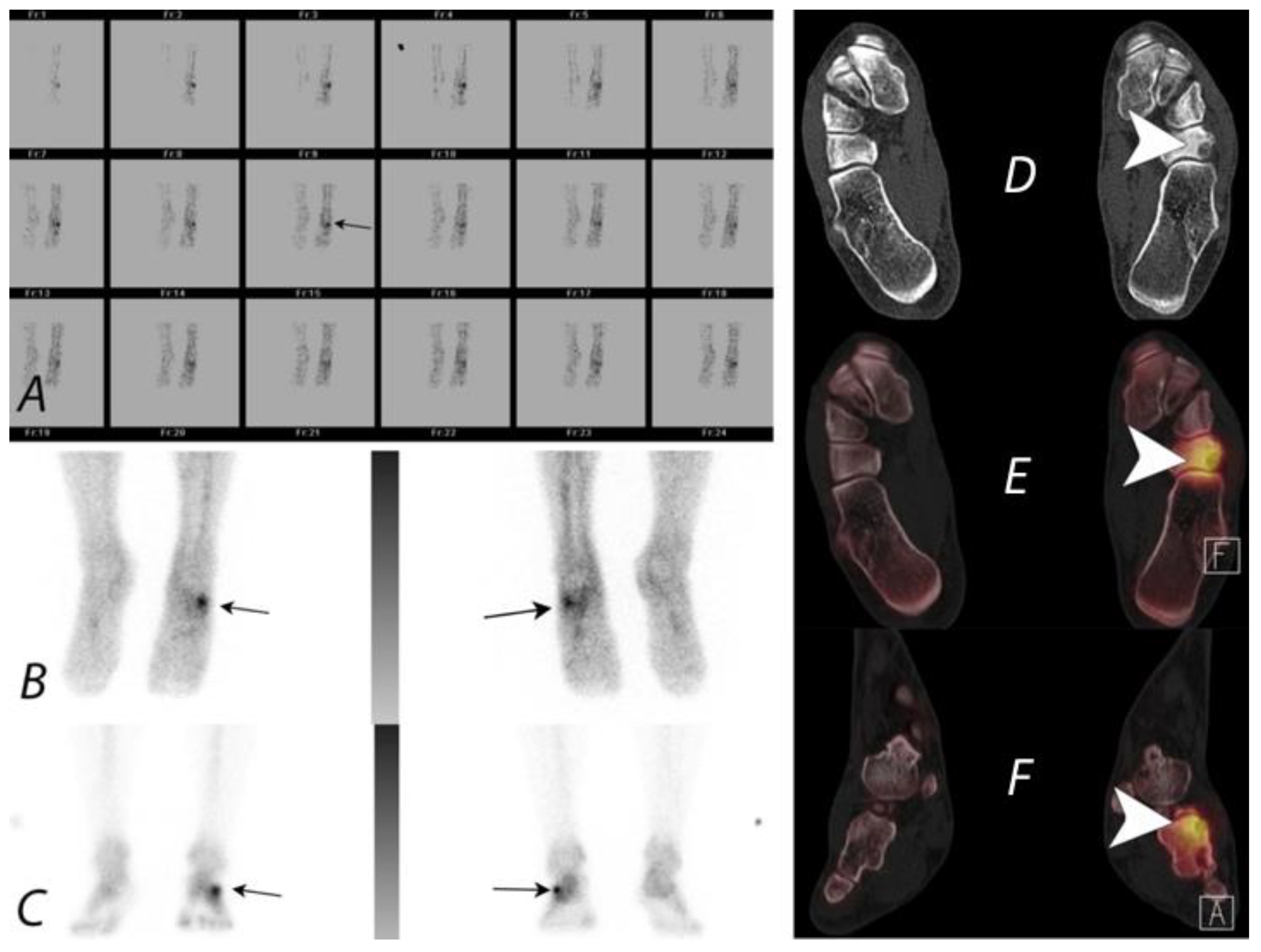Tomography 07 00050 g011