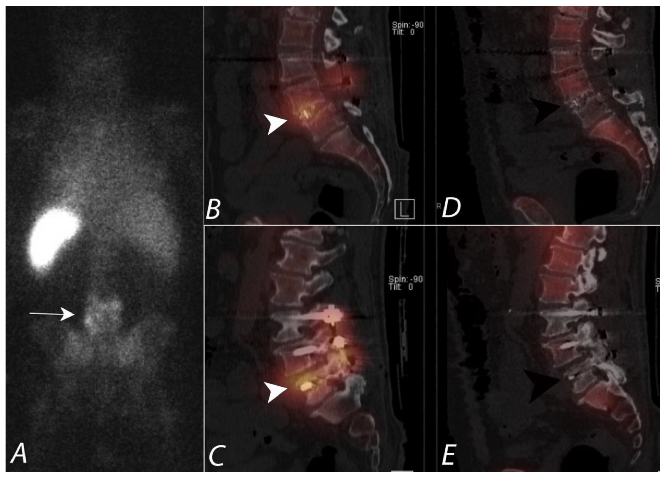Tomography 07 00050 g013