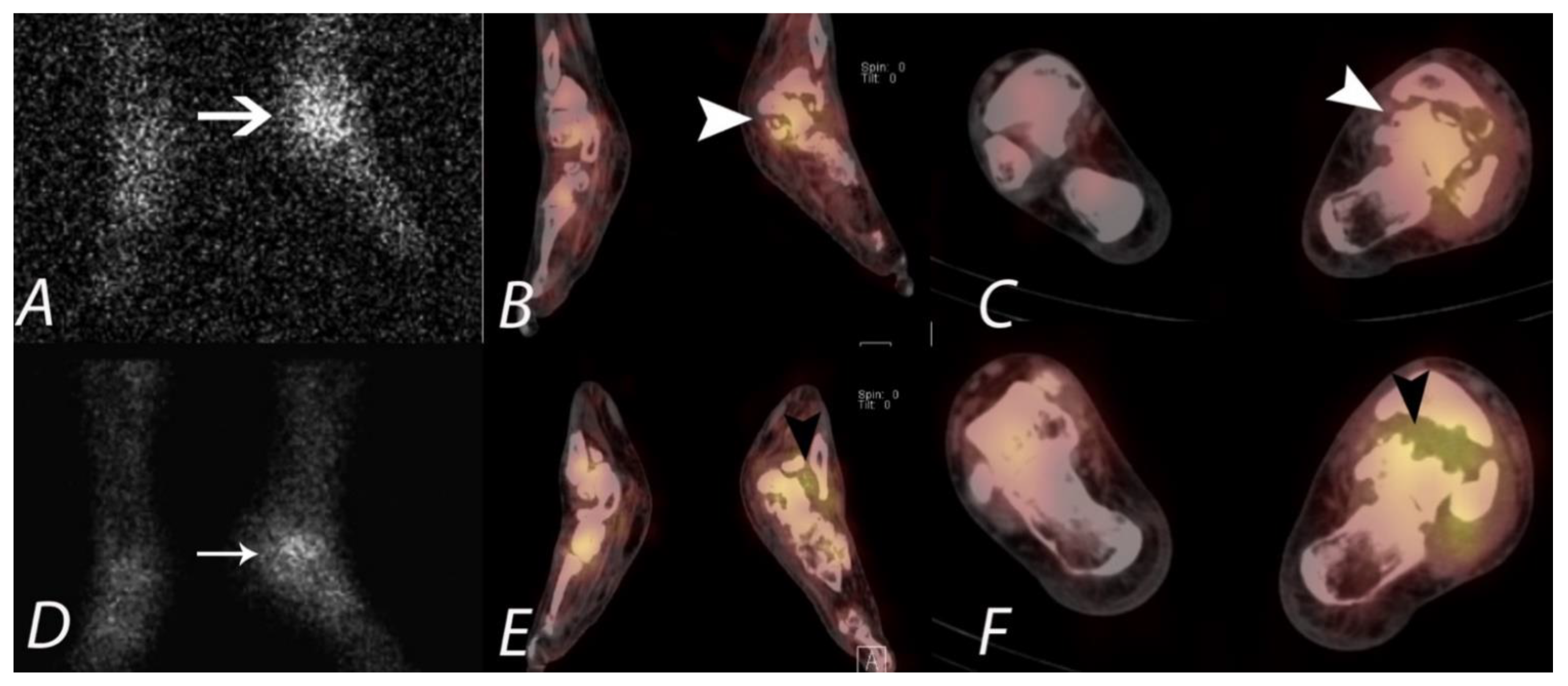 Tomography 07 00050 g014