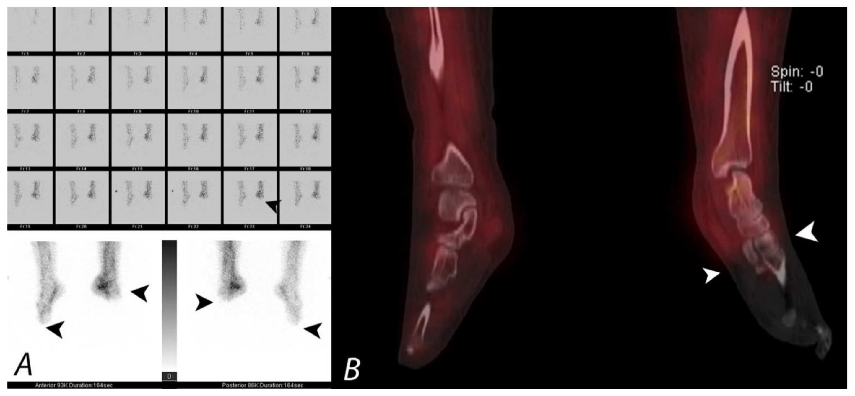 Tomography 07 00050 g017