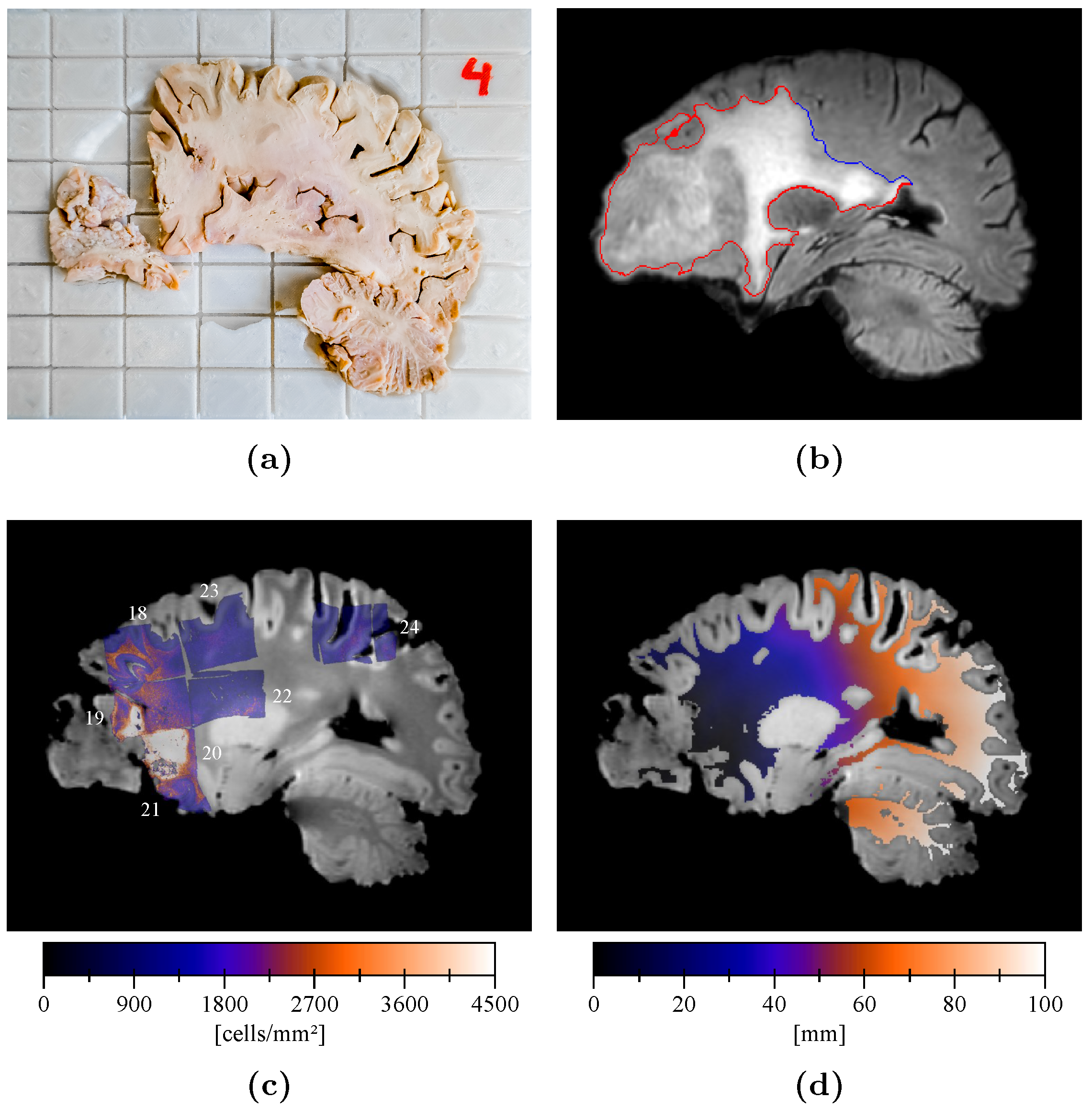 Tomography 07 00055 g003