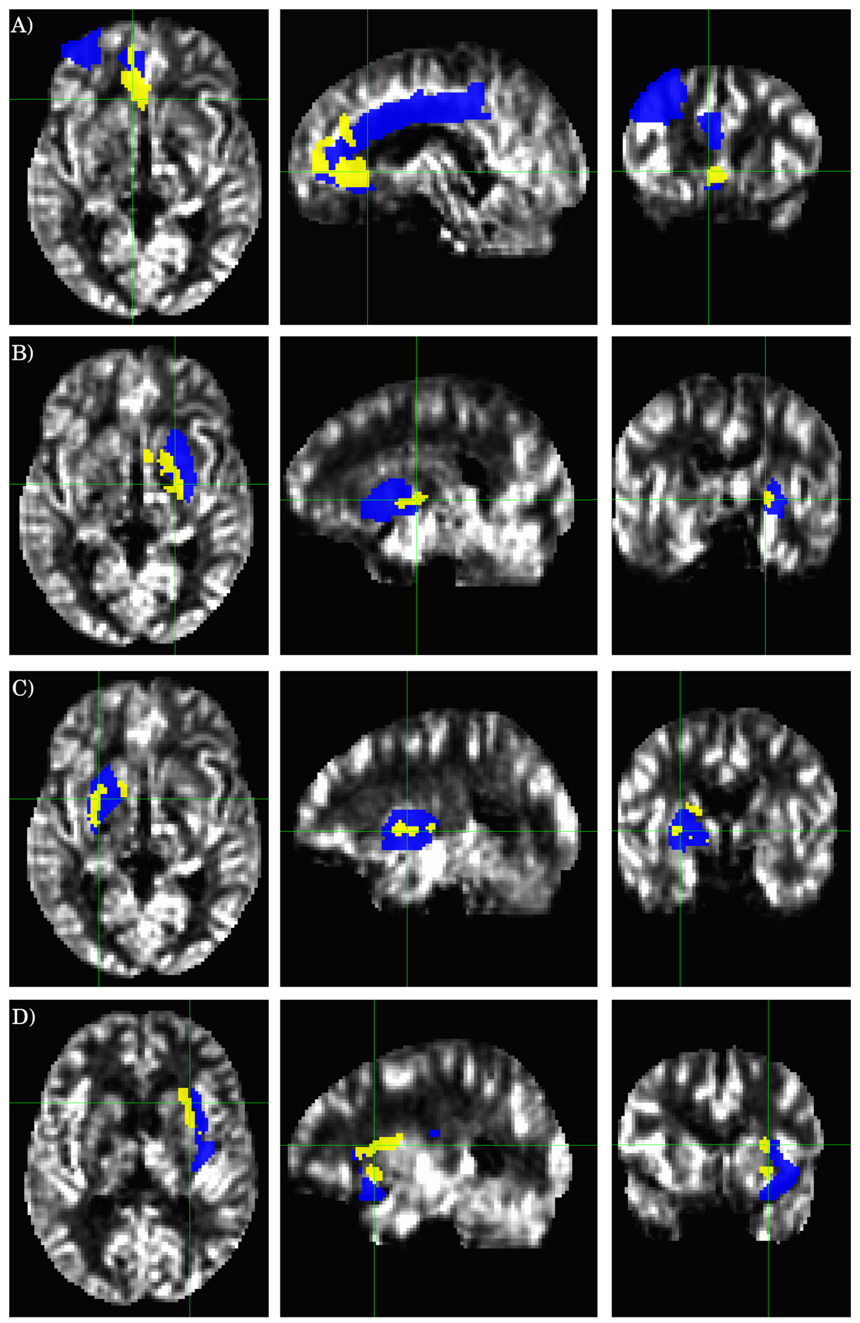 Tomography 07 00056 g003