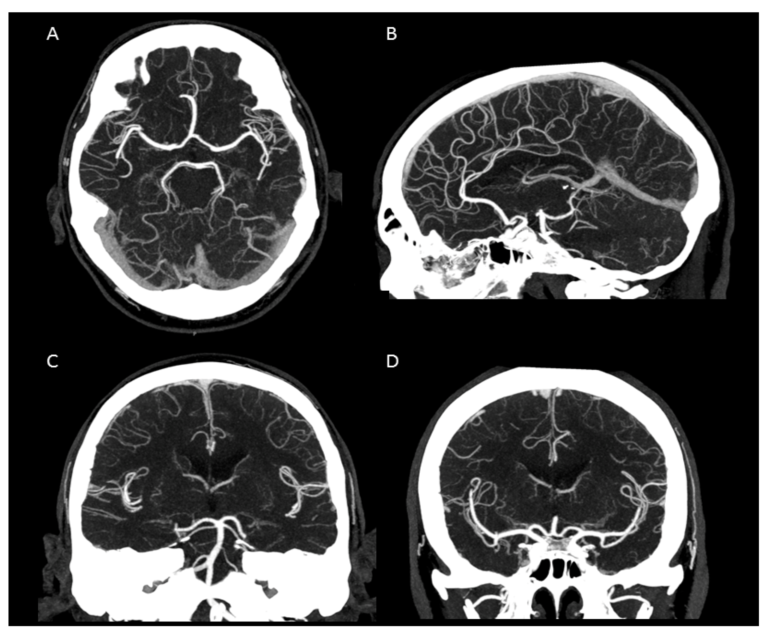 Tomography 07 00059 g003 550