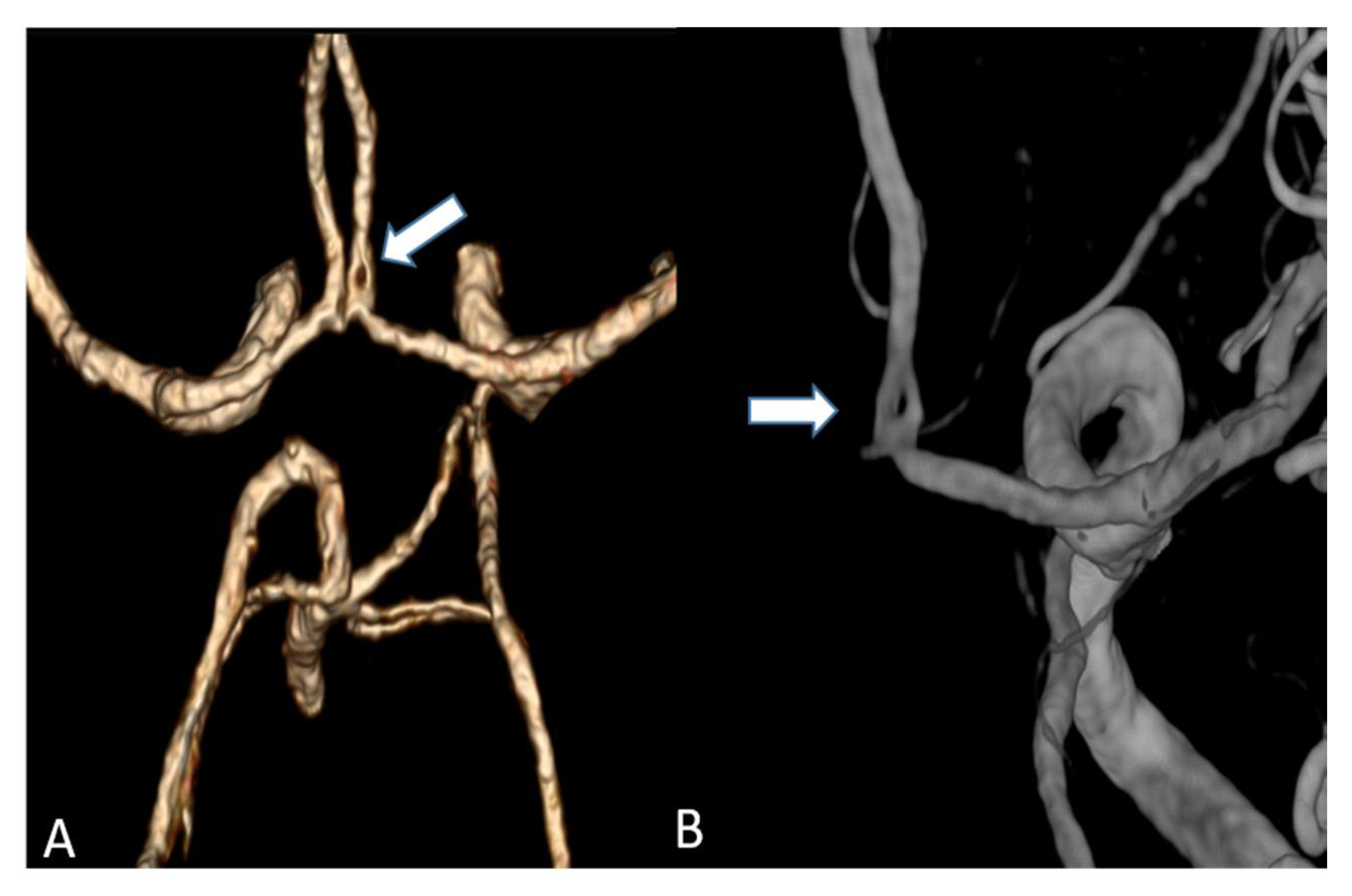 Tomography 07 00059 g005 550