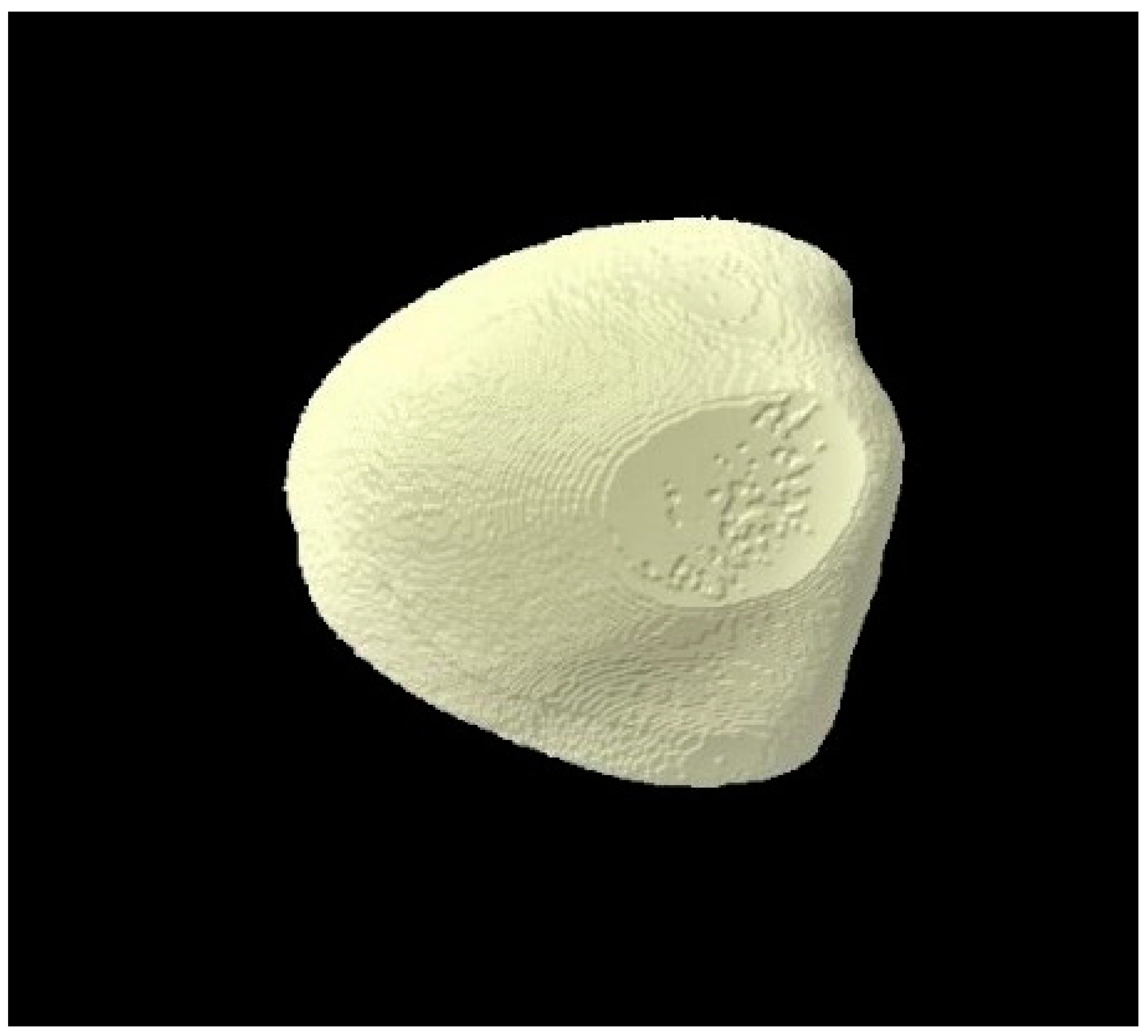 Tomography 07 00063 g005