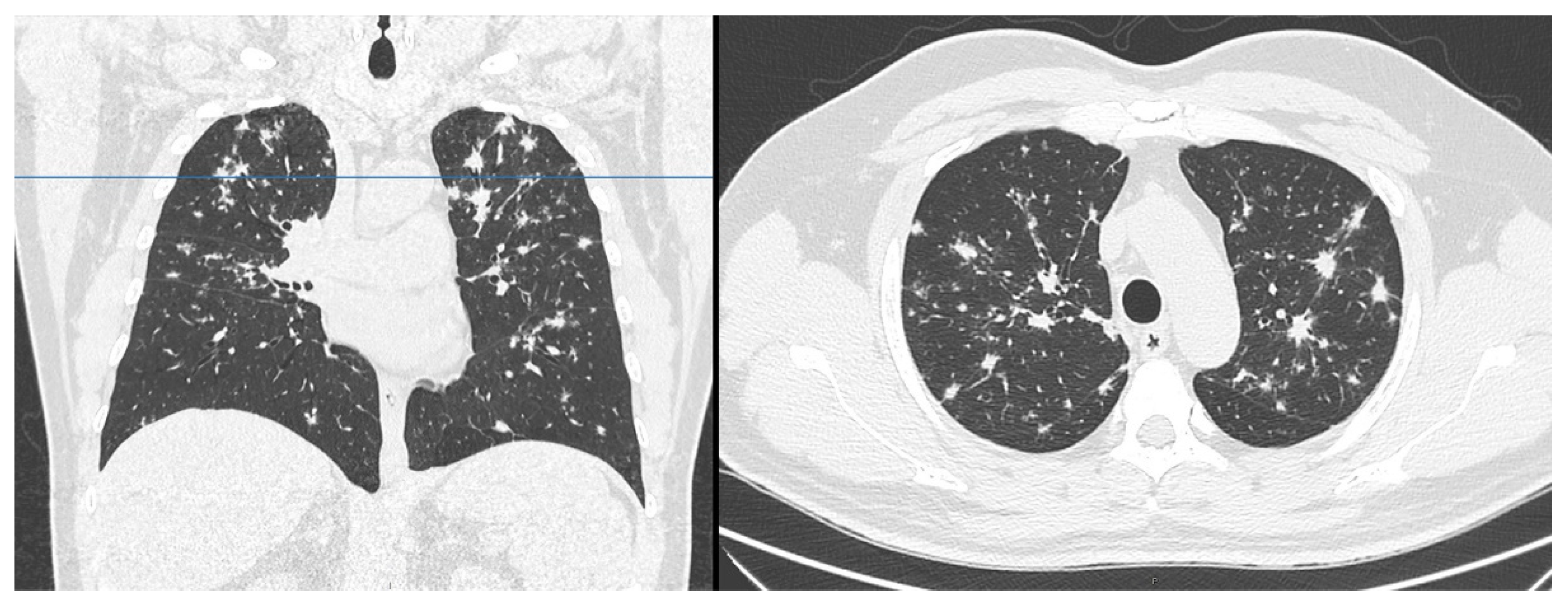 Tomography 07 00065 g001