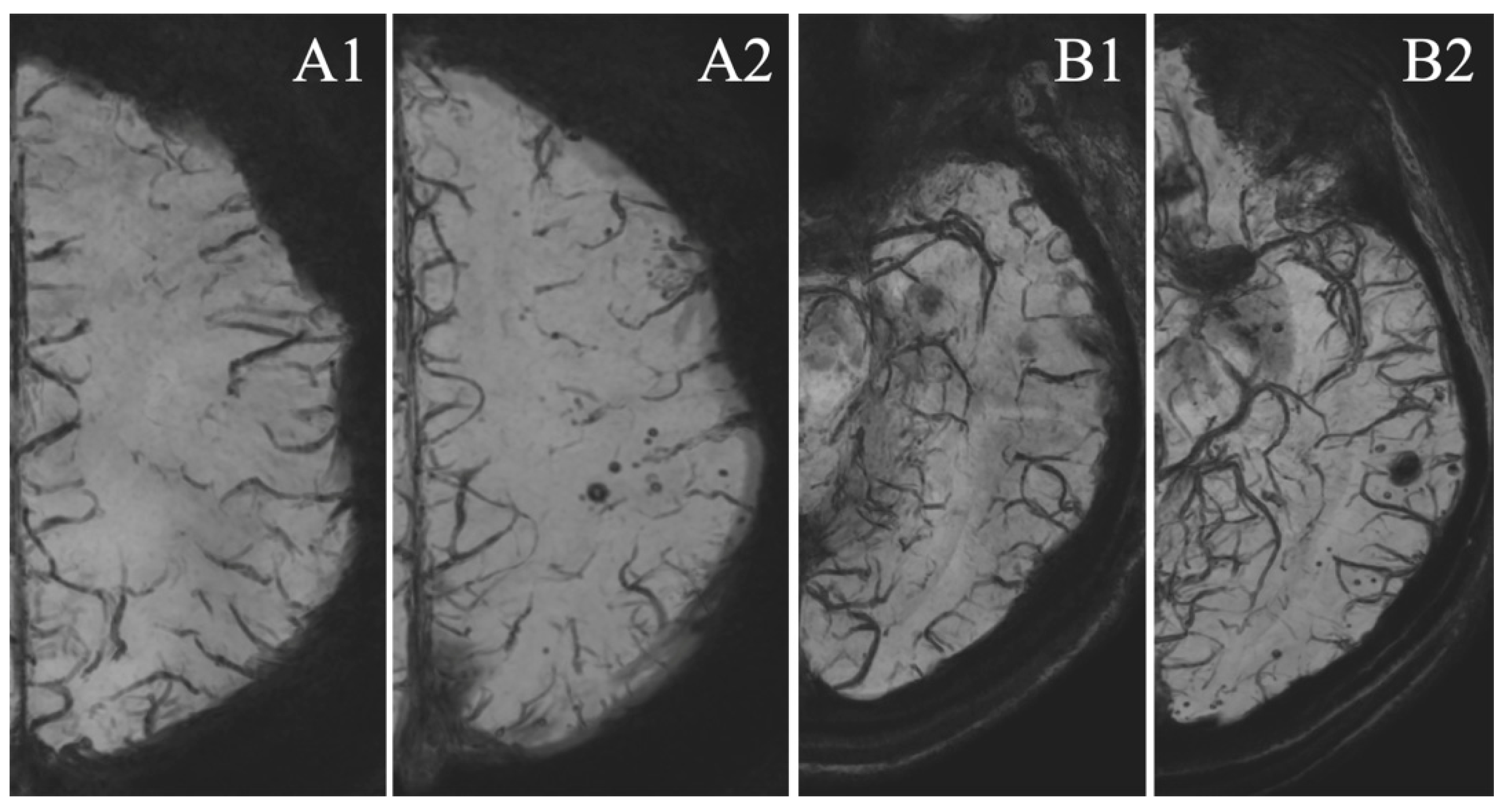 Tomography 07 00066 g001