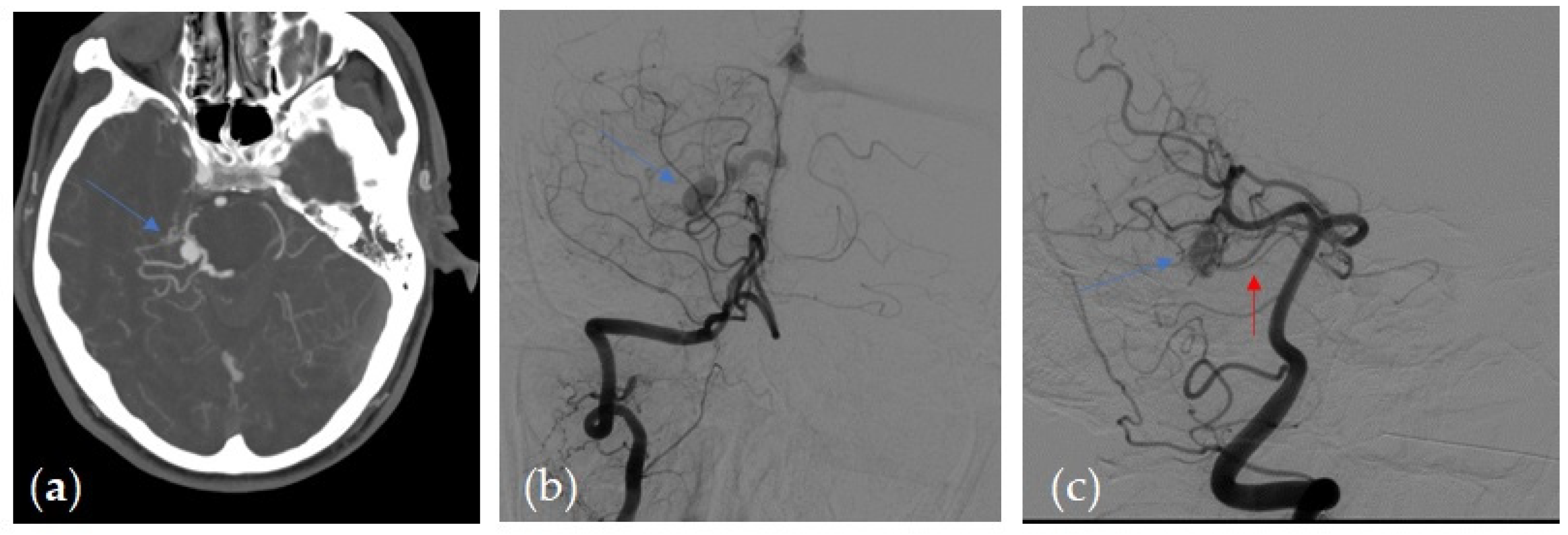 Tomography 07 00068 g001
