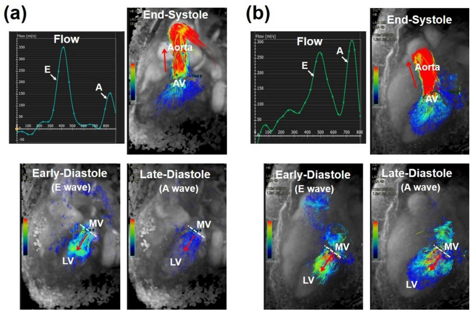 Echocardiography and cardiovascular magnetic resonance based evaluation of myocardial  strain and relationship with late gadolinium enhancement, Journal of  Cardiovascular Magnetic Resonance