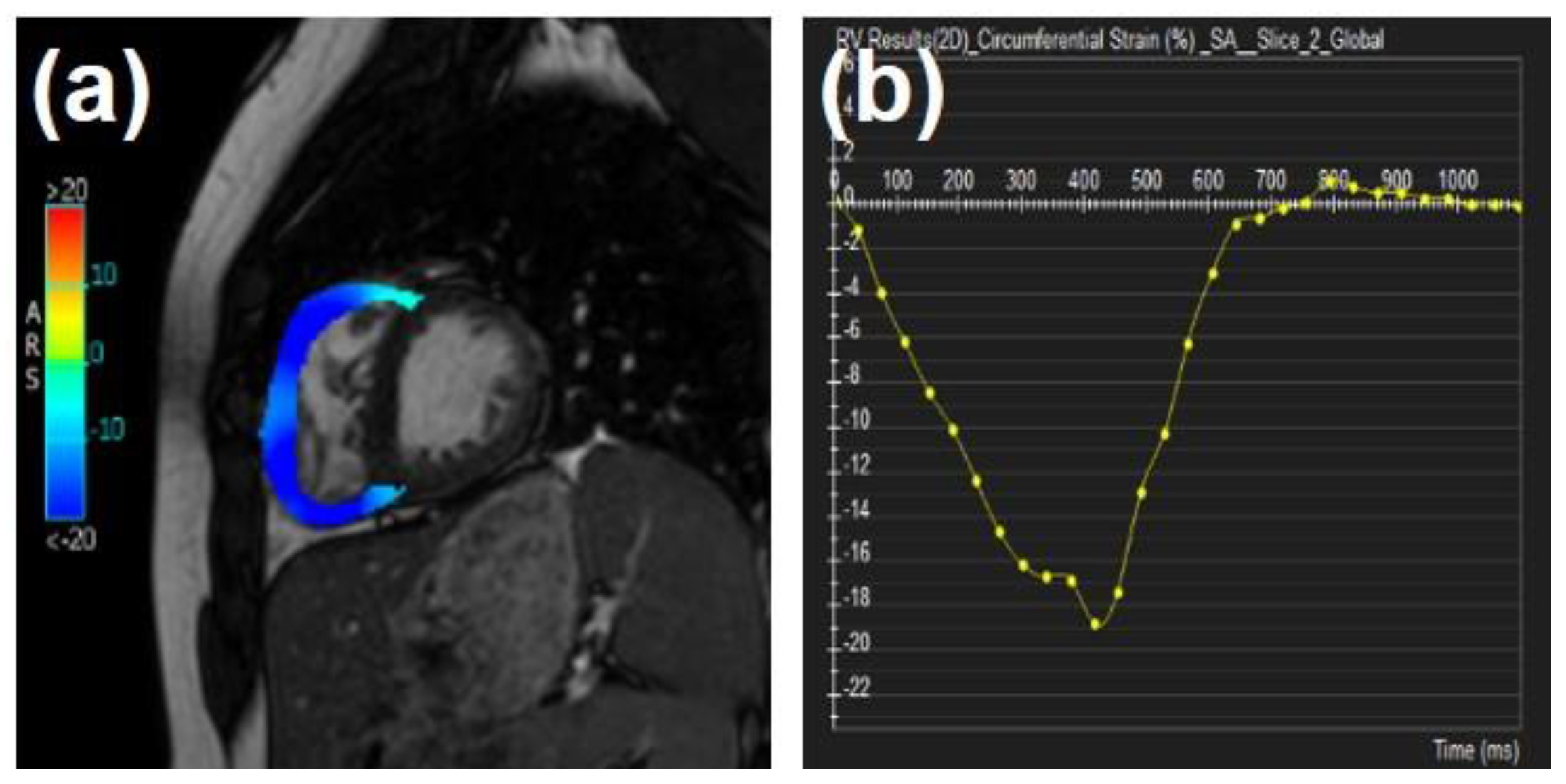Tomography 07 00075 g007
