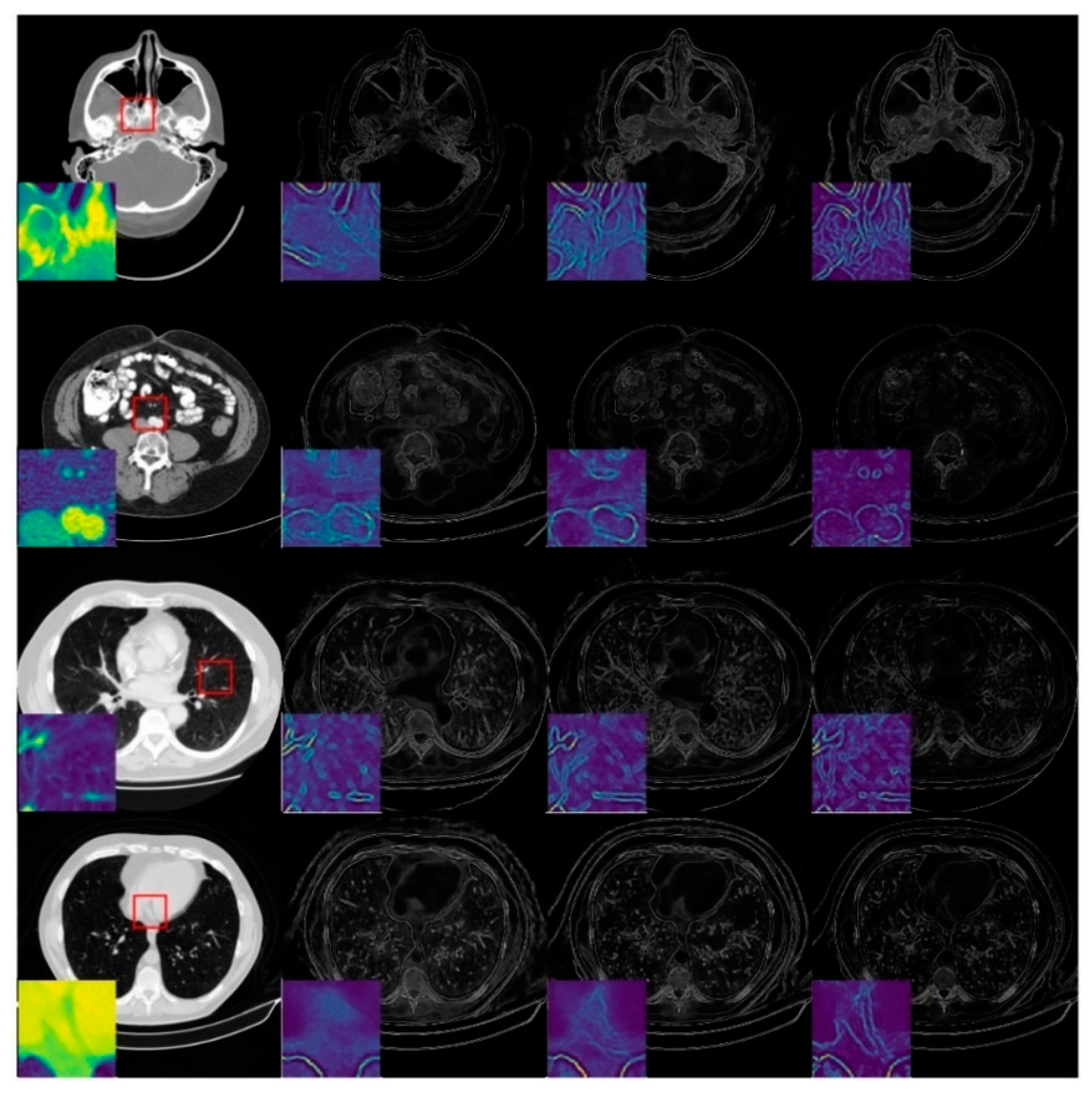 Tomography 07 00077 g007