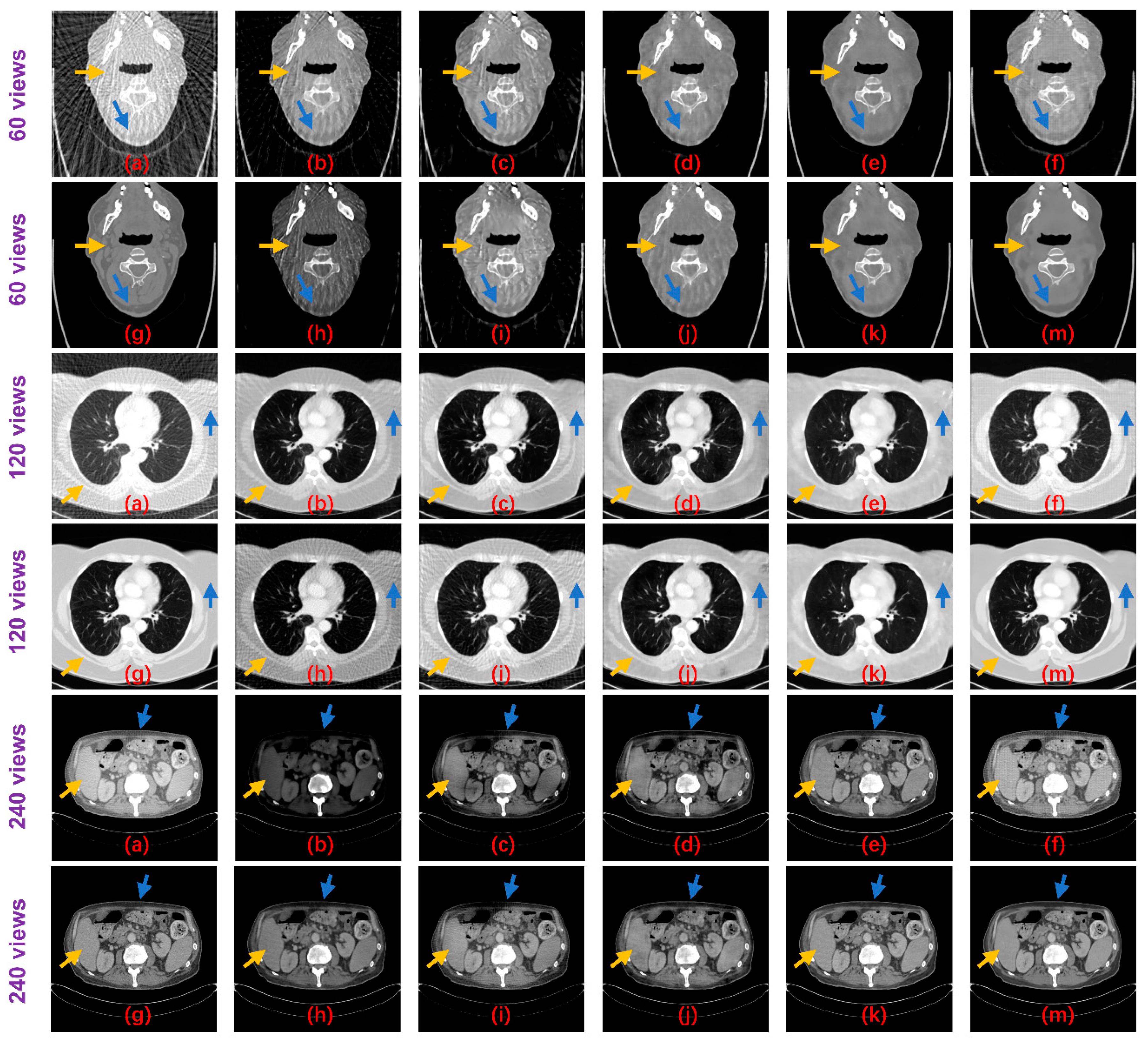 Tomography 07 00077 g008