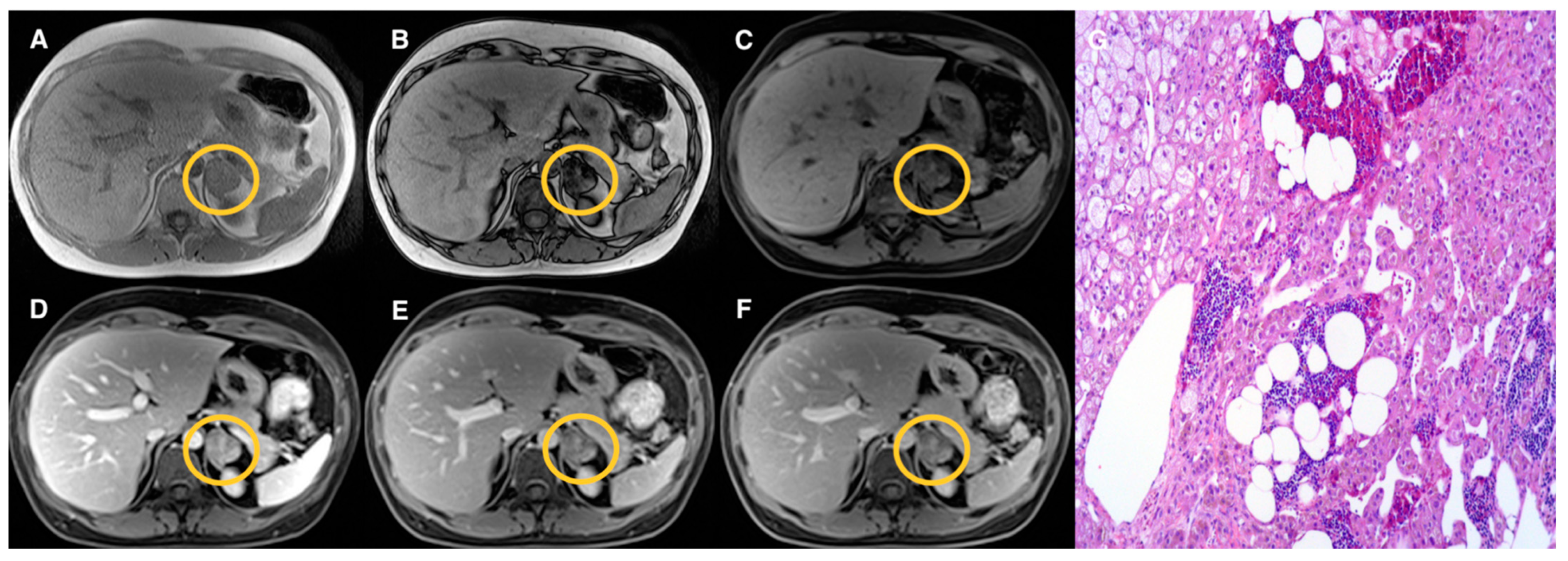 Tomography 07 00079 g003