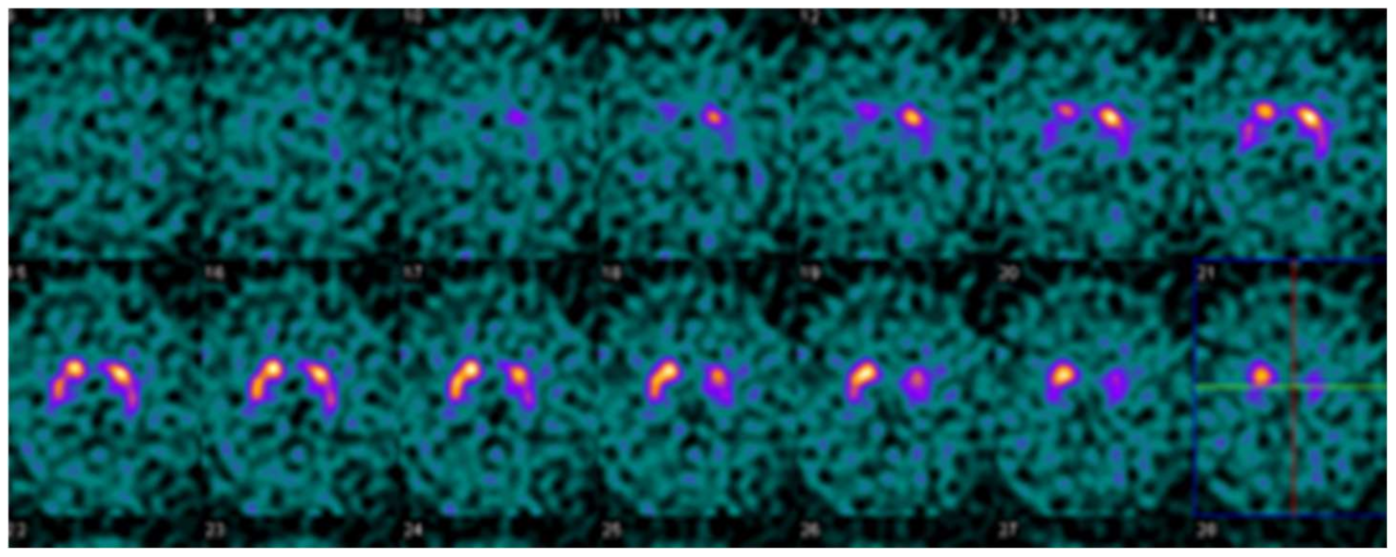 Tomography 07 00081 g003 Tomography 07 00081 g003