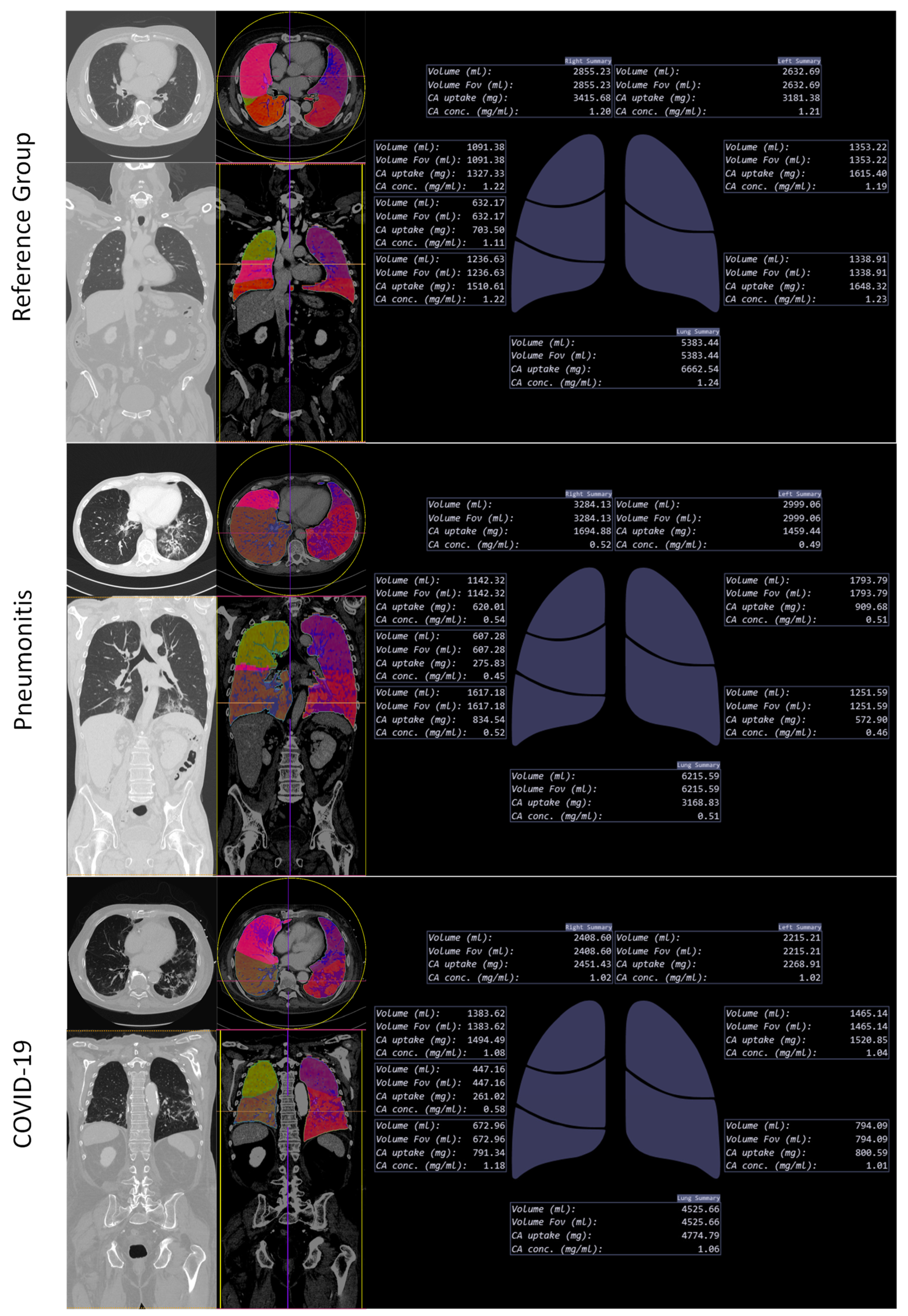Tomography 08 00003 g004