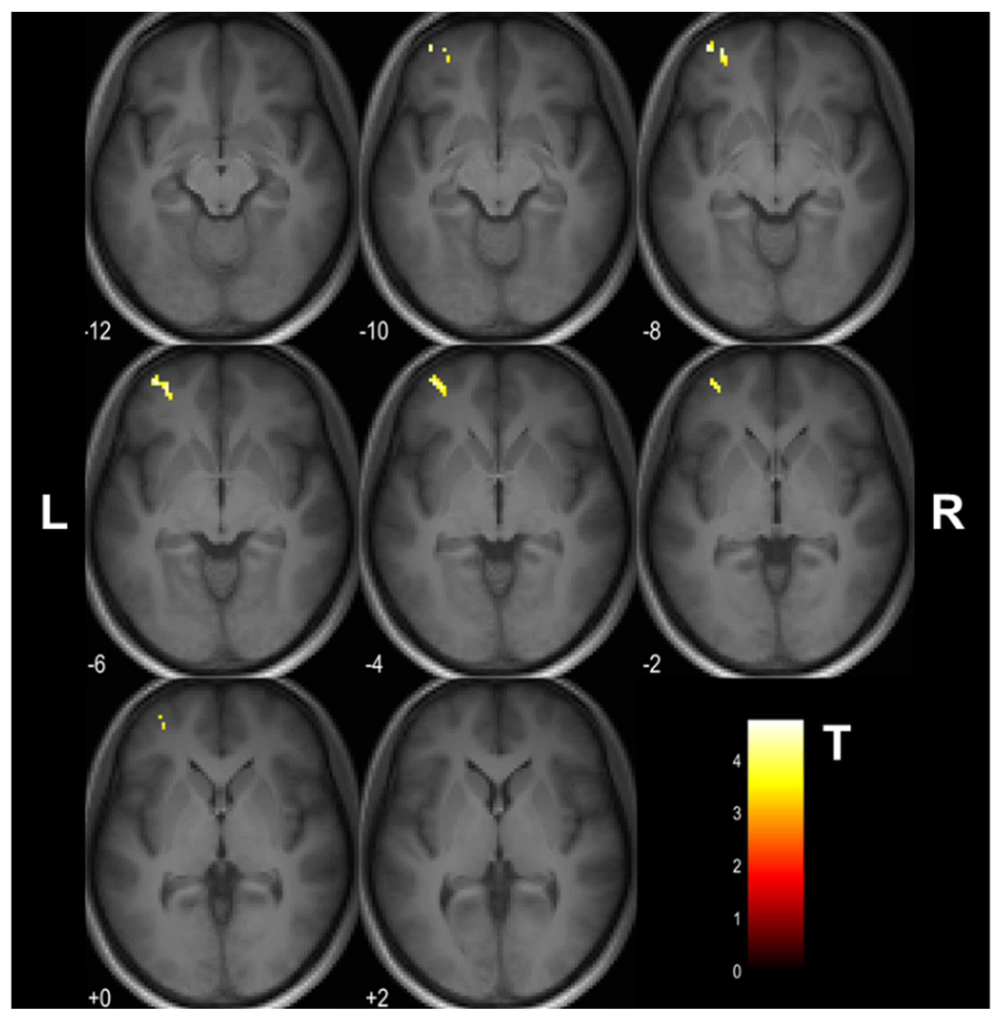 Tomography 08 00004 g003