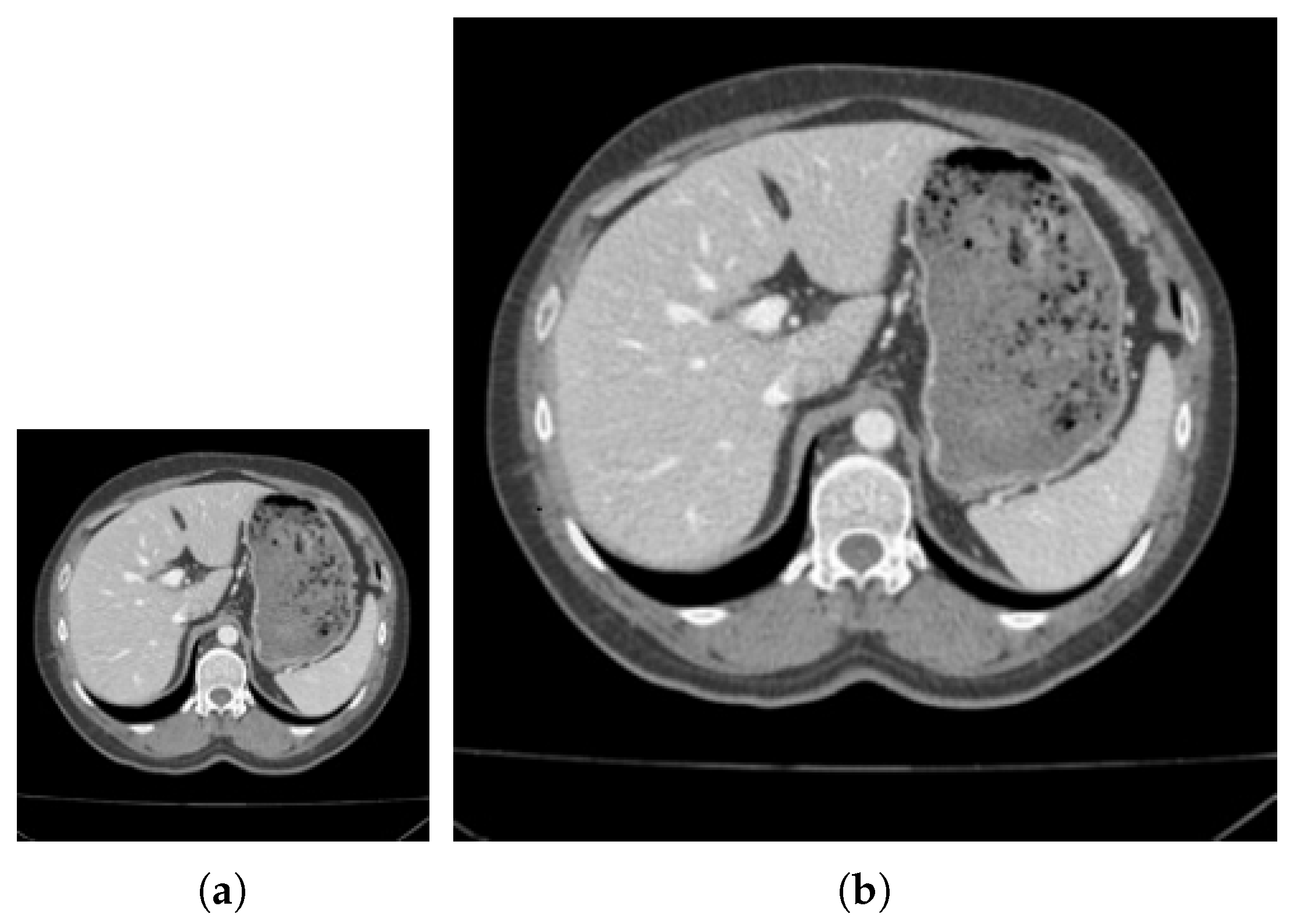 Tomography 08 00006 g002a