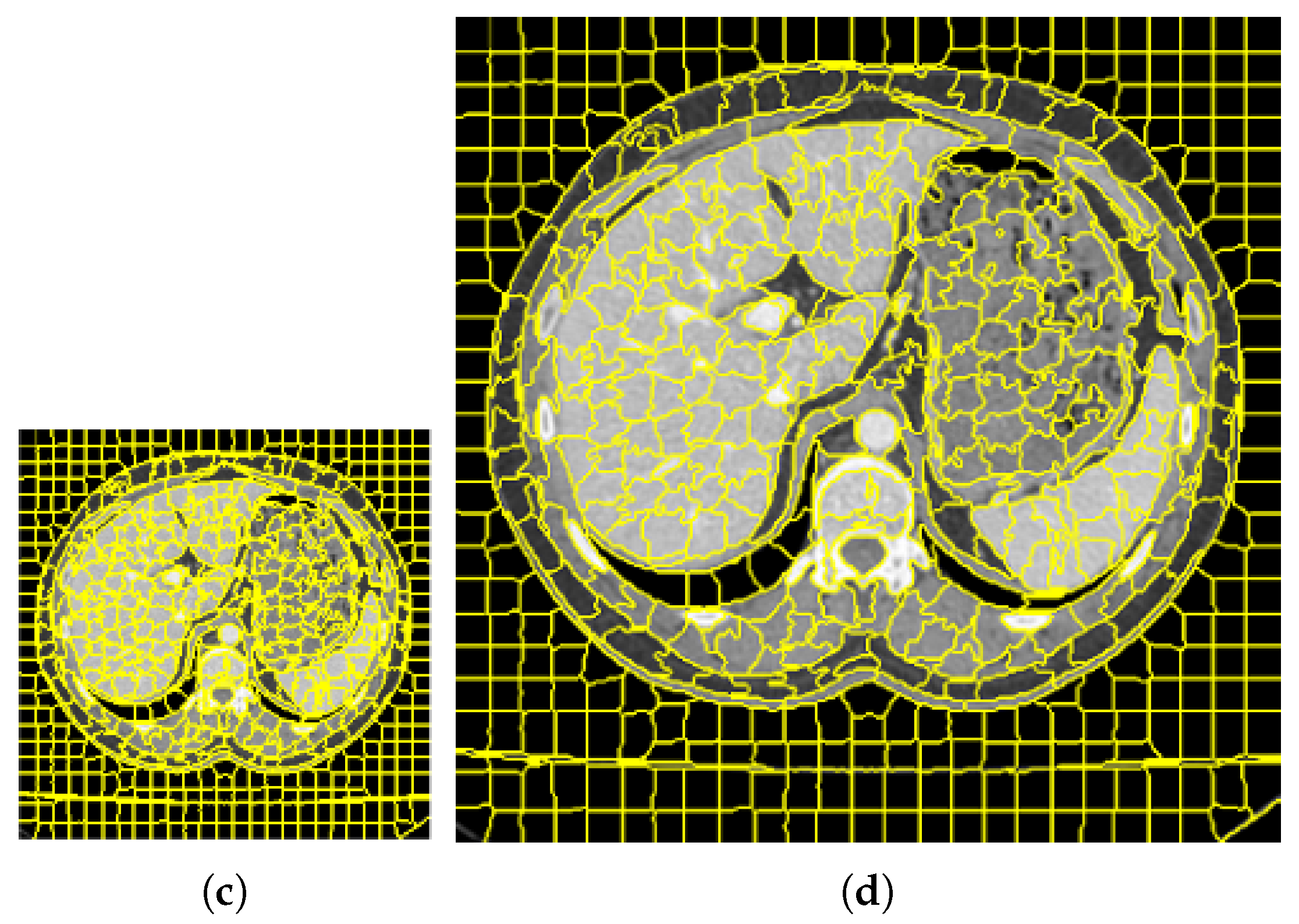 Tomography 08 00006 g002b