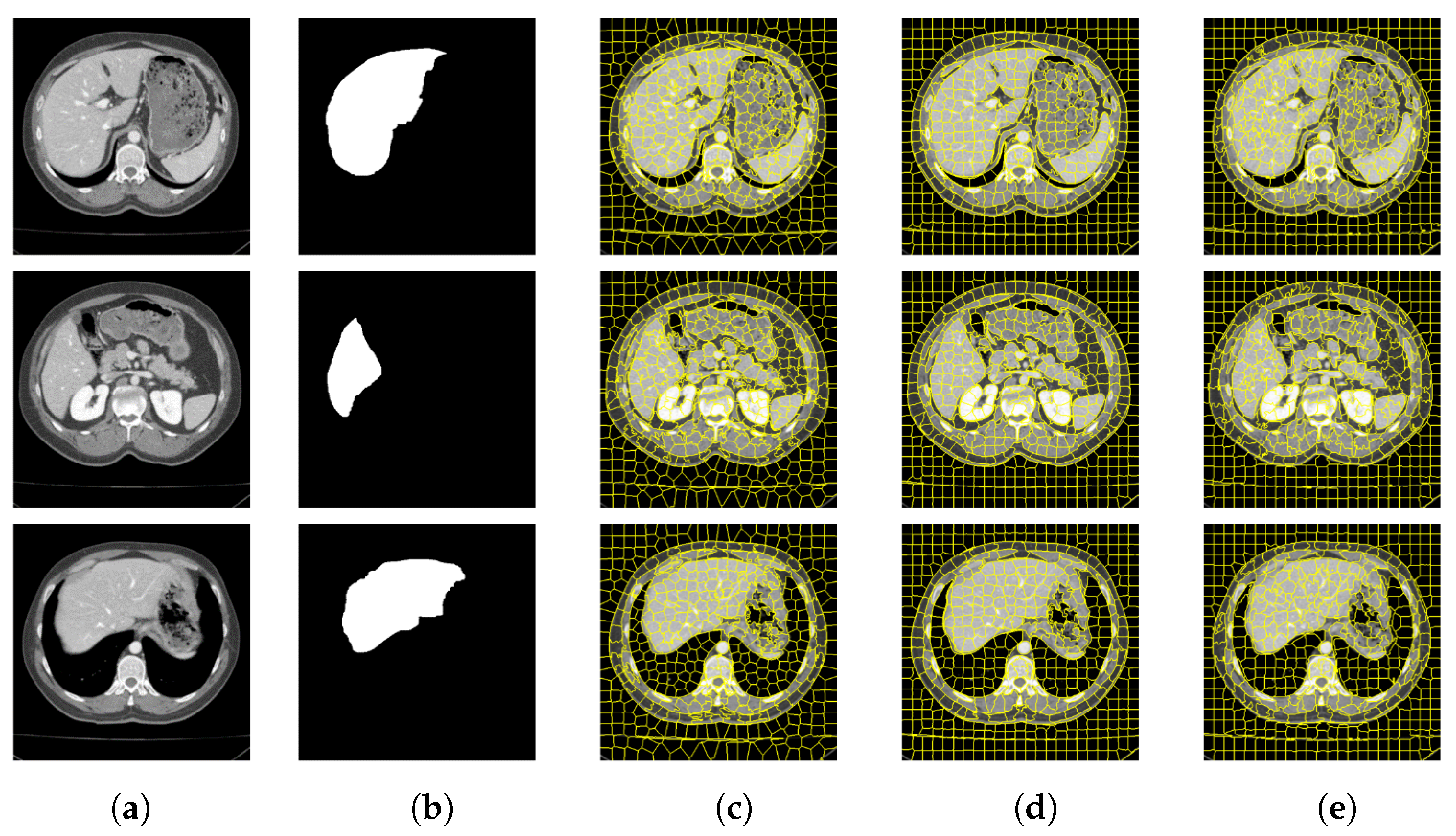Tomography 08 00006 g010