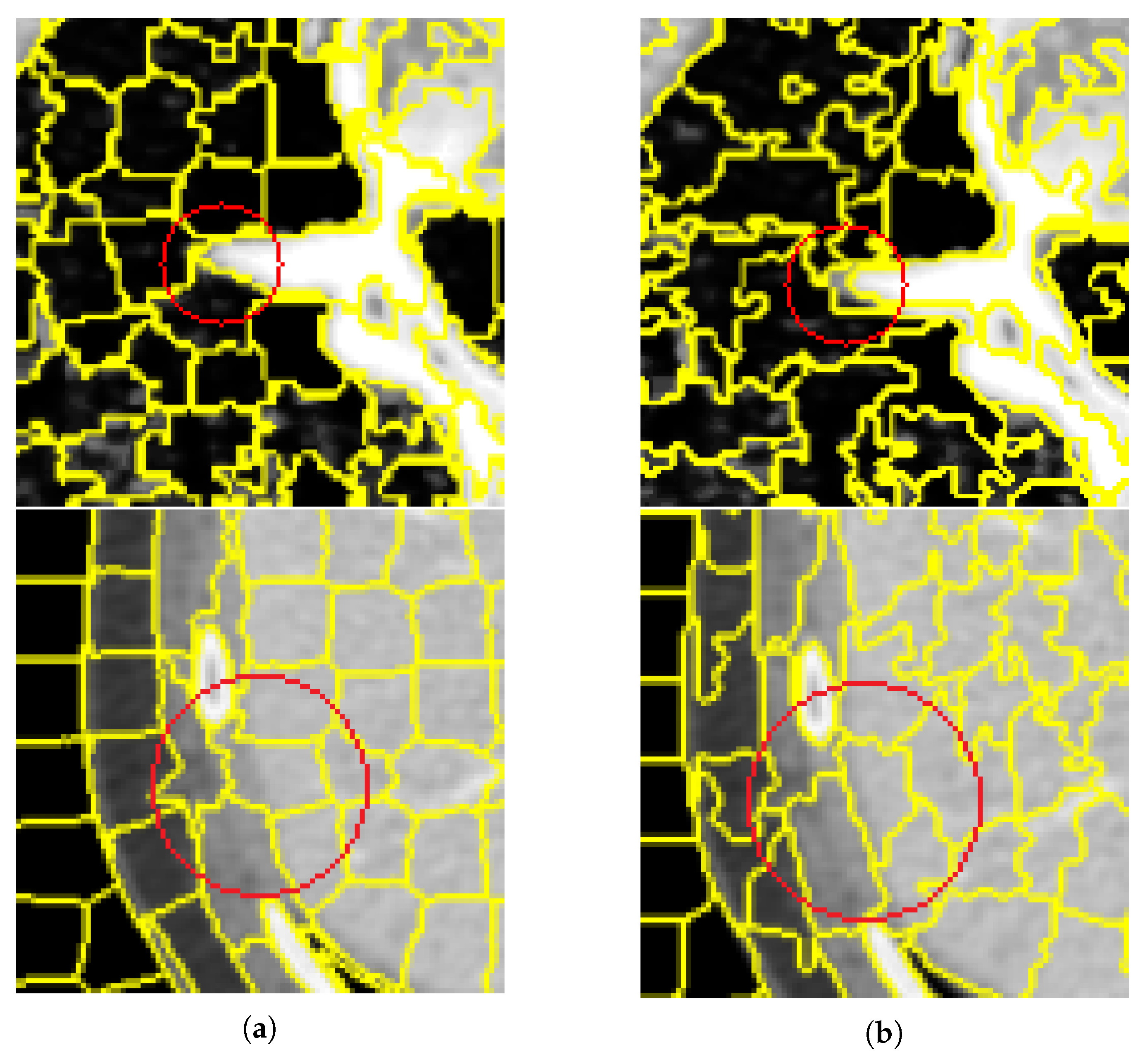 Tomography 08 00006 g011