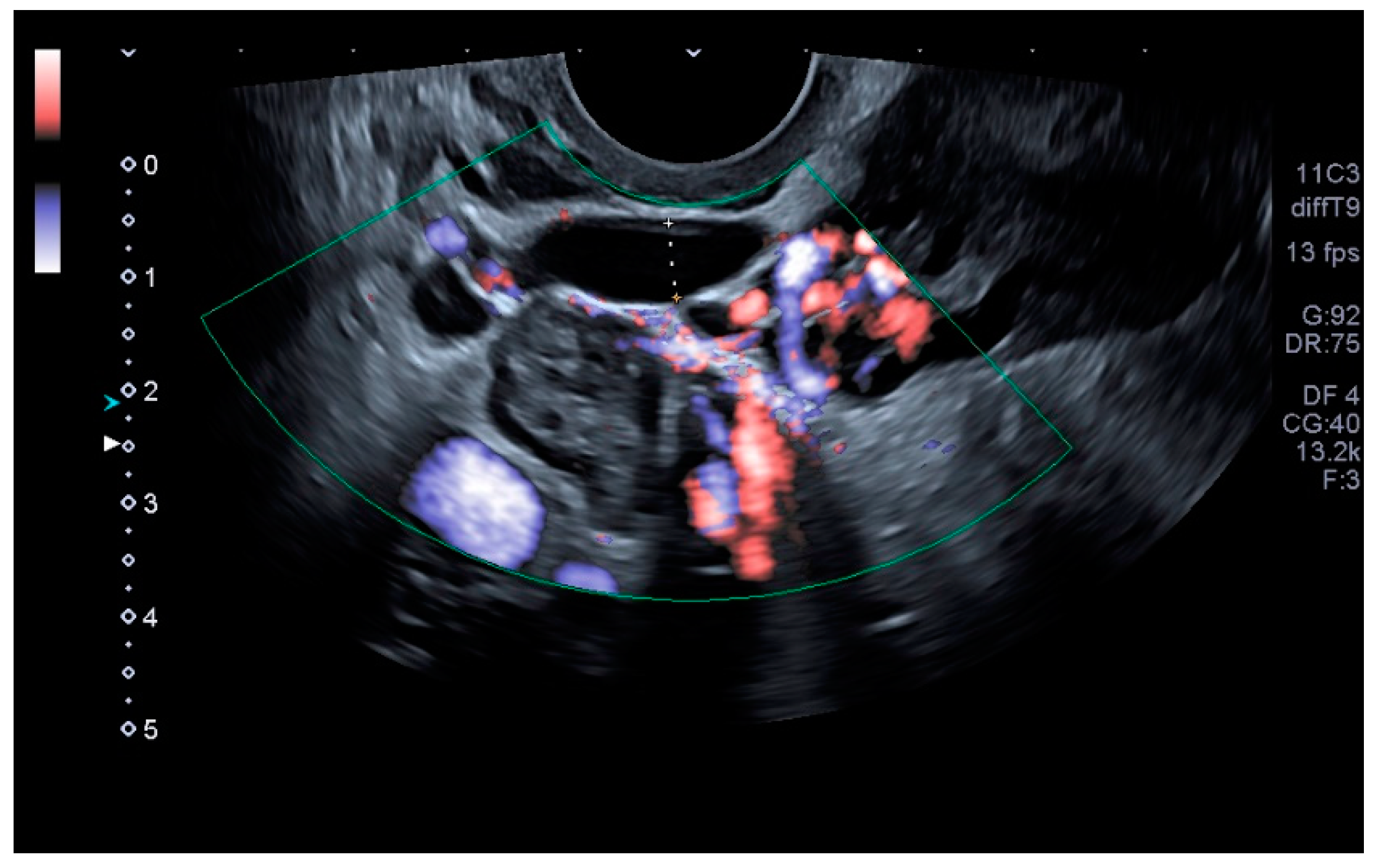 Tomography 08 00008 g002 550
