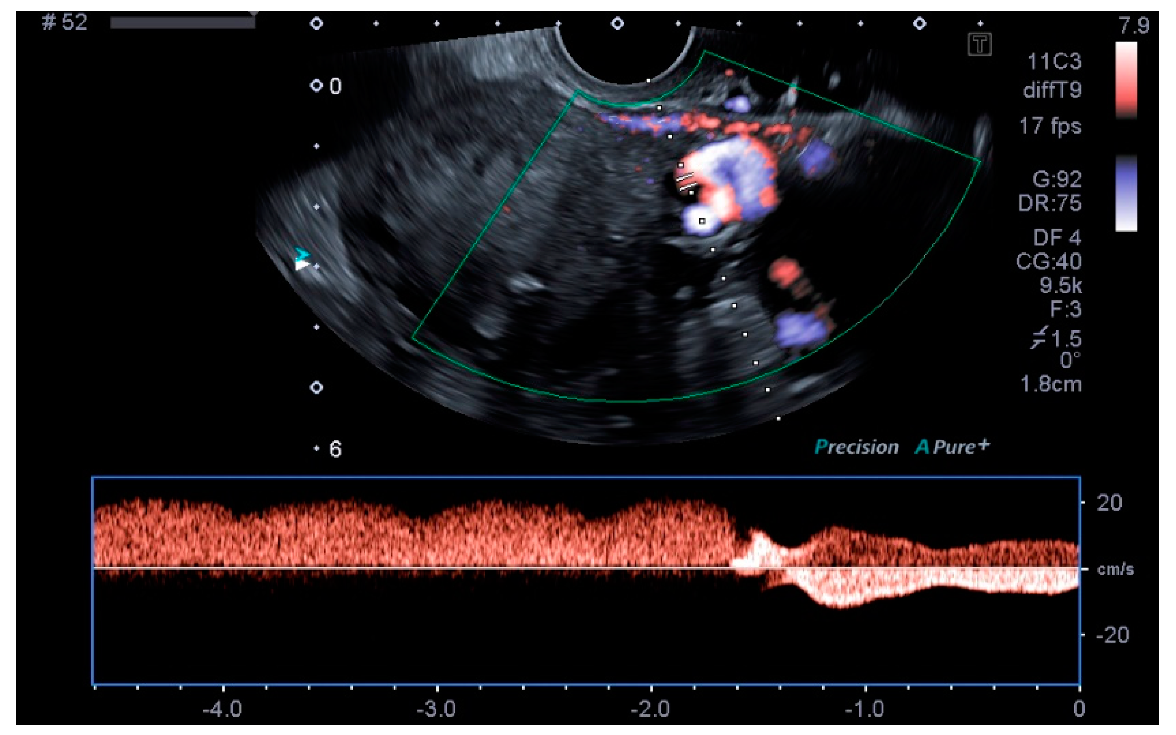 Tomography 08 00008 g004 550