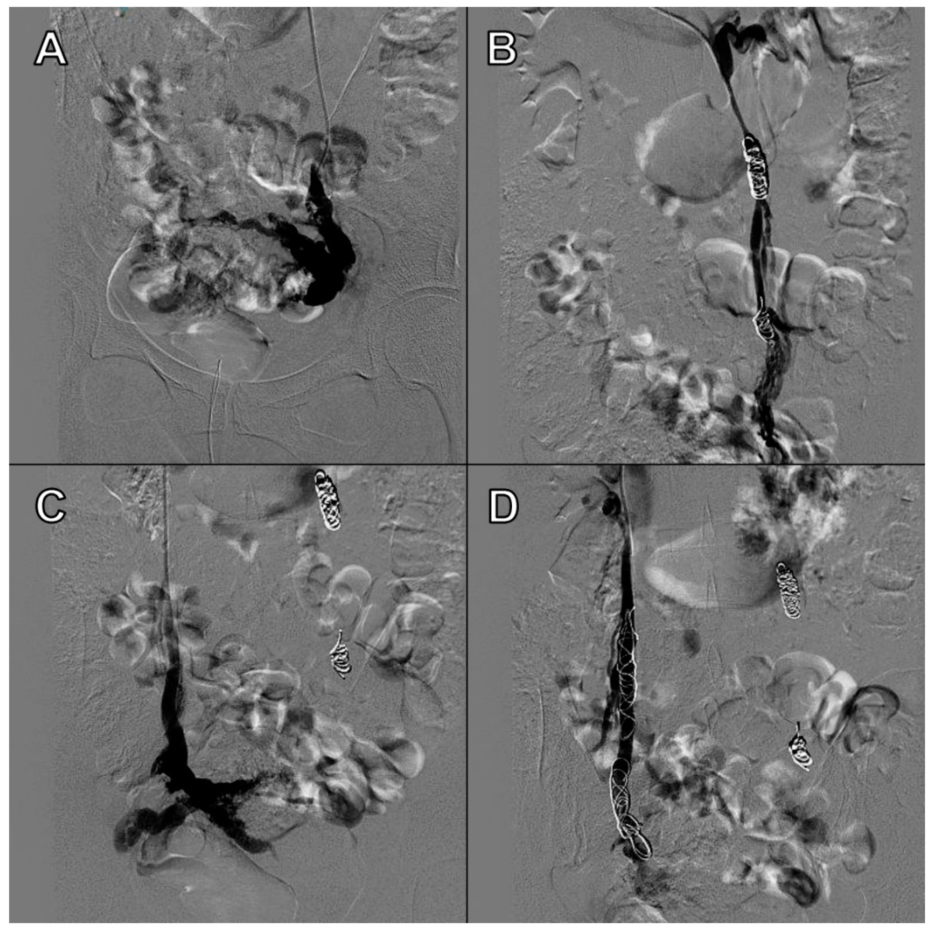 Tomography 08 00008 g005 550