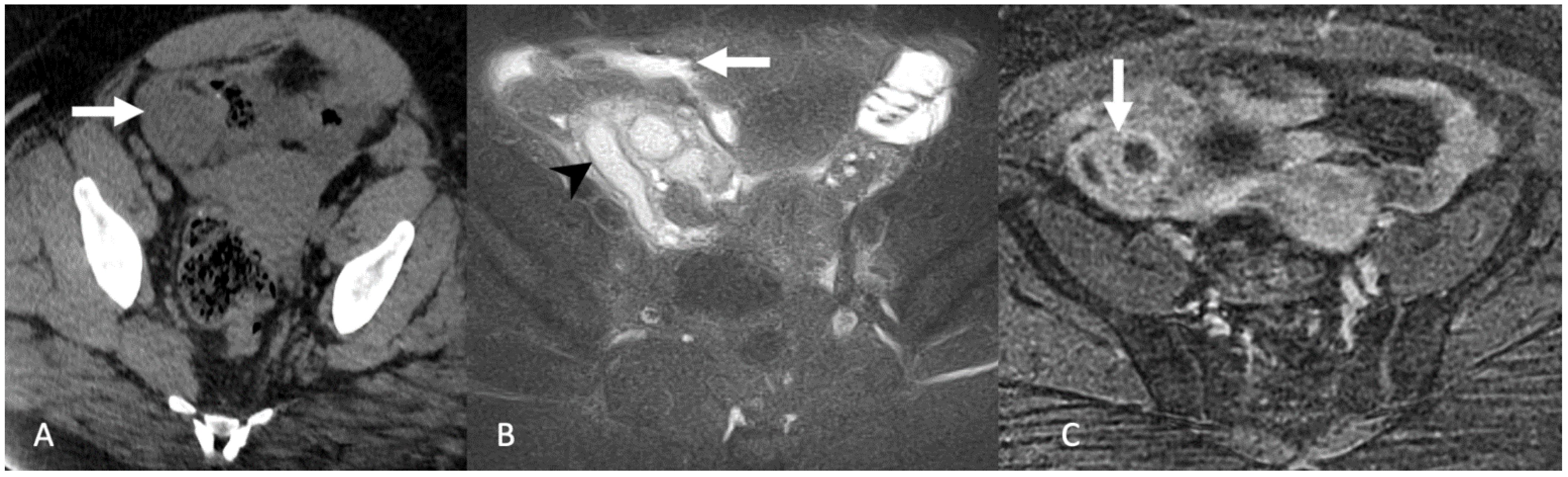 Tomography 08 00009 g004