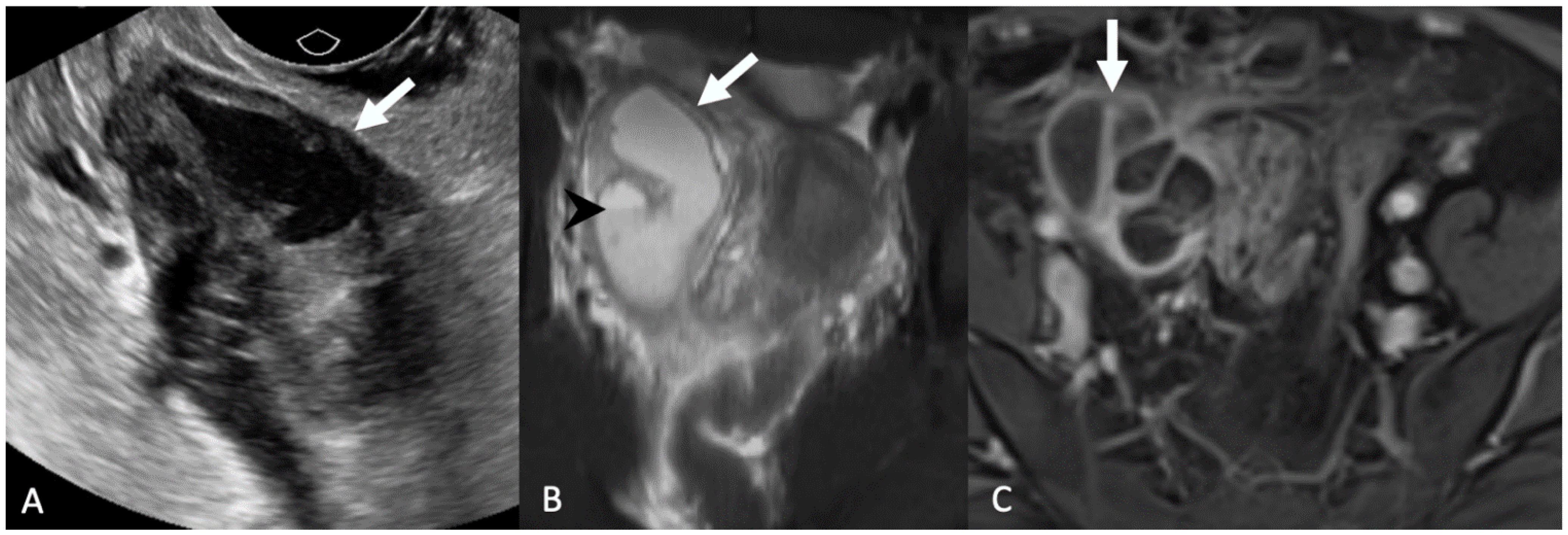Tomography 08 00009 g005