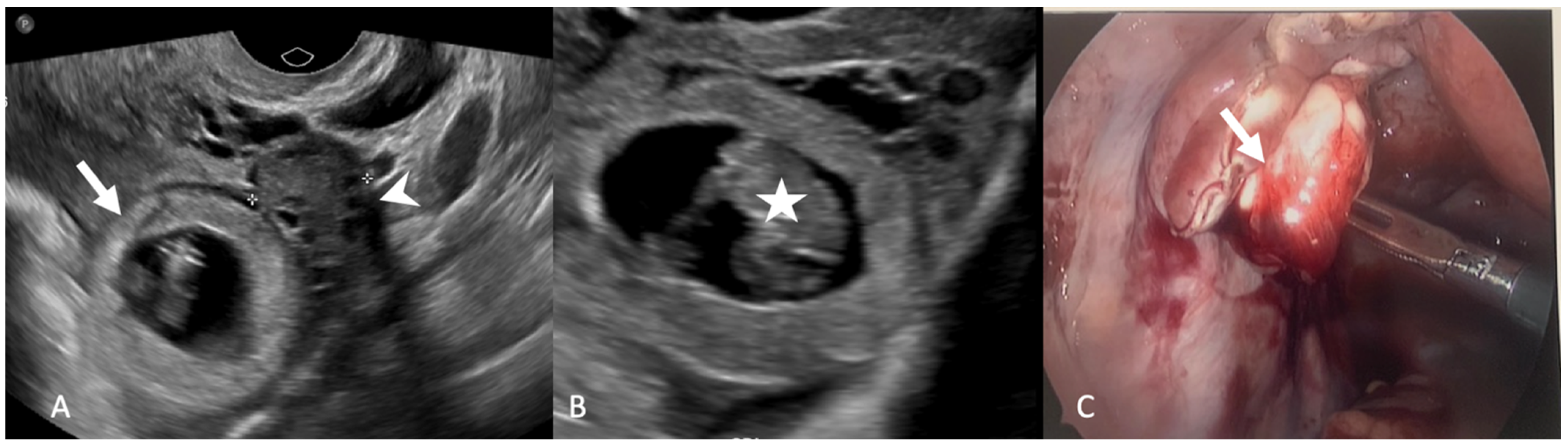 Tomography 08 00009 g006