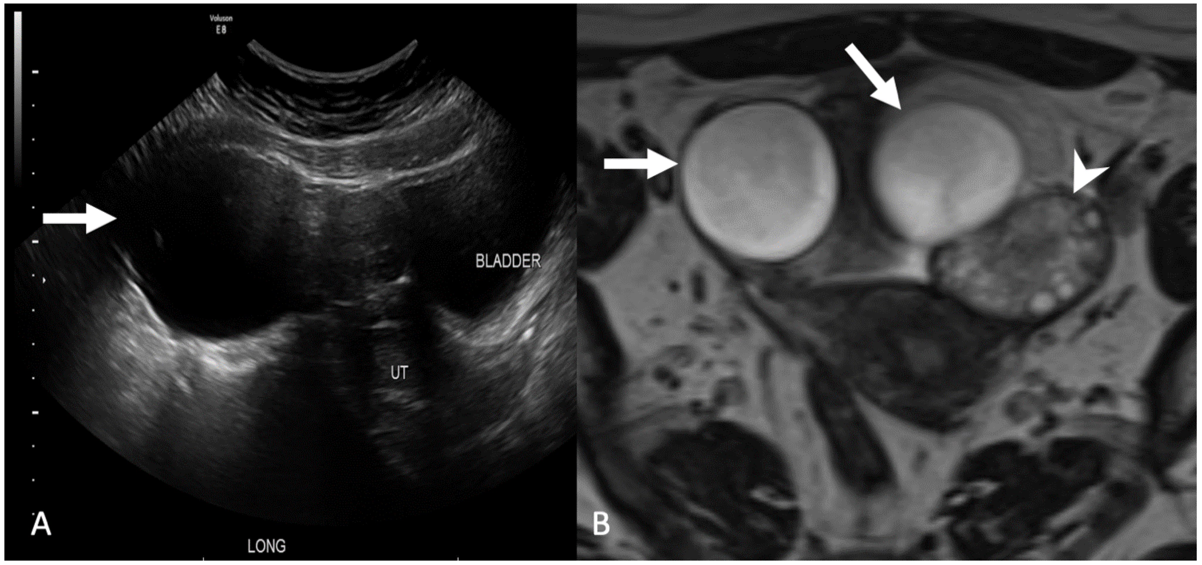 Tomography 08 00009 g008