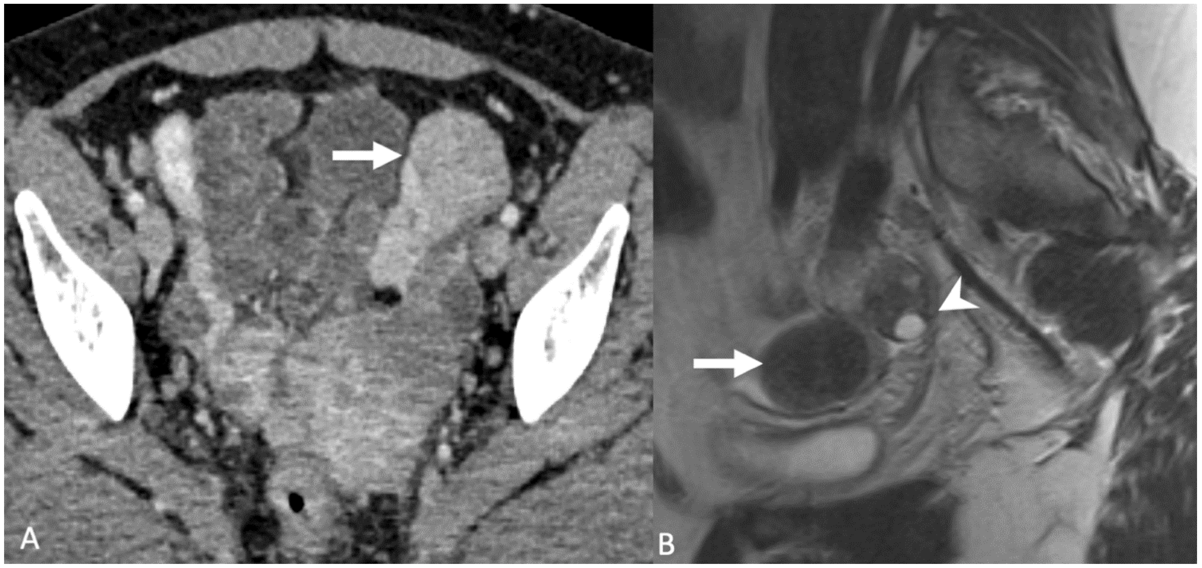 Tomography 08 00009 g010