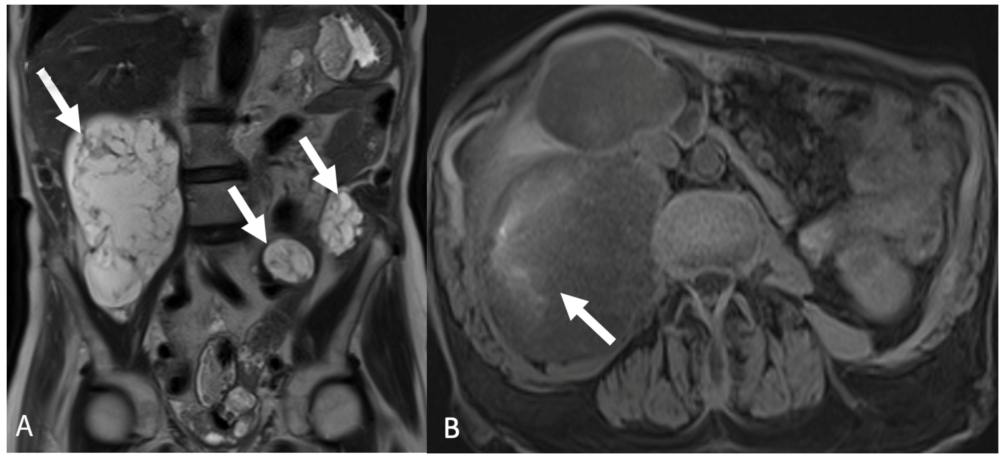 Tomography 08 00009 g012
