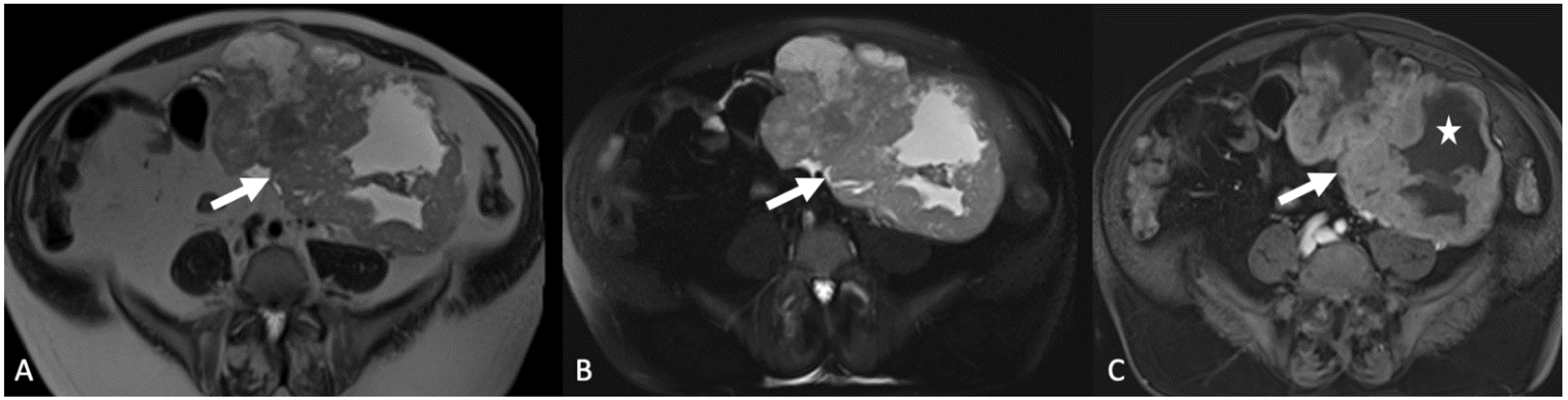 Tomography 08 00009 g013