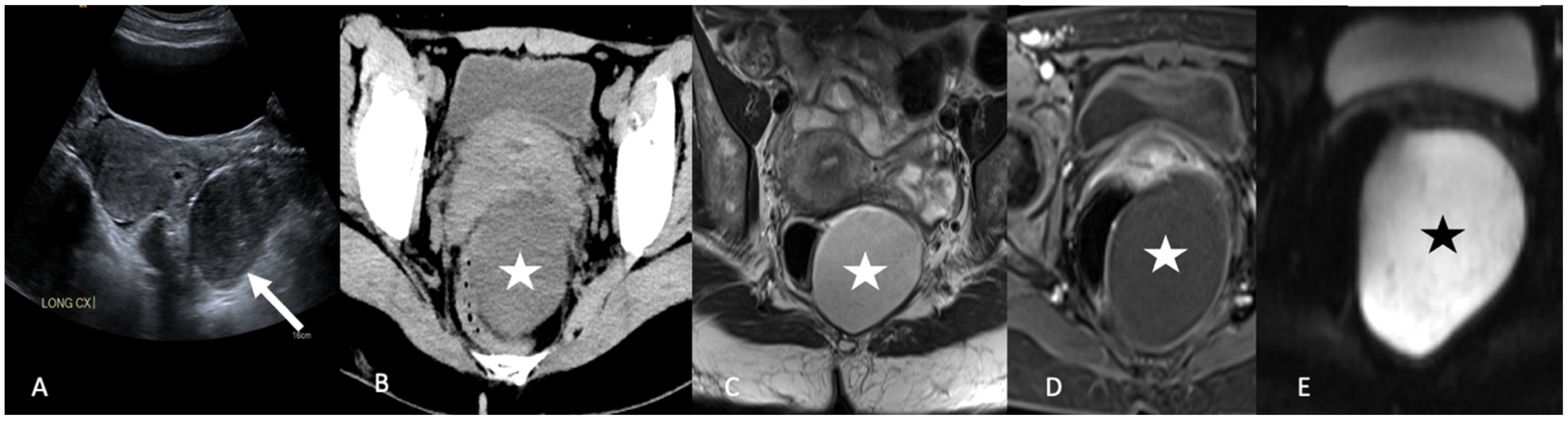 Tomography 08 00009 g014